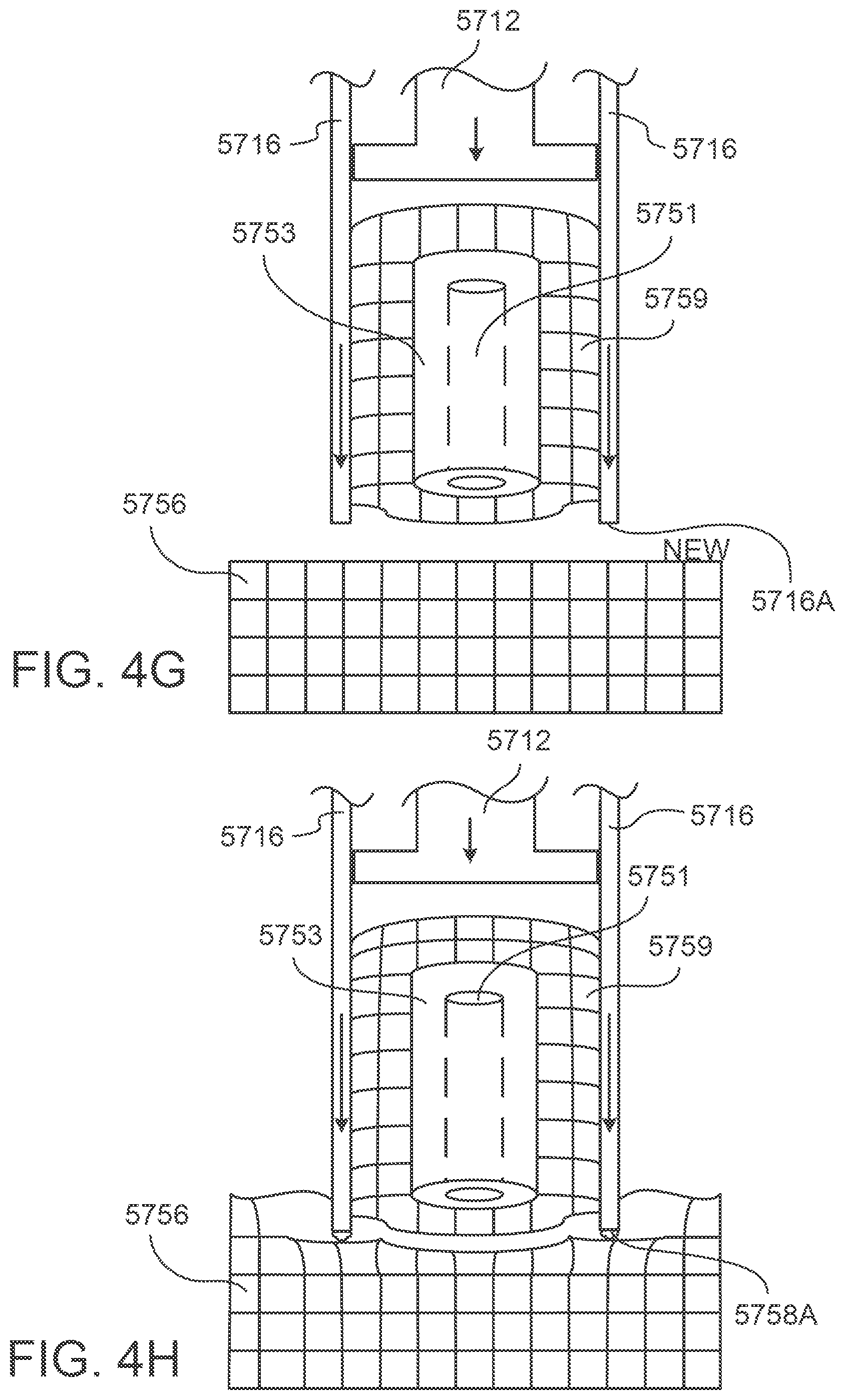 Patent US12297416 Figure 19 – System and method for transferring tissue