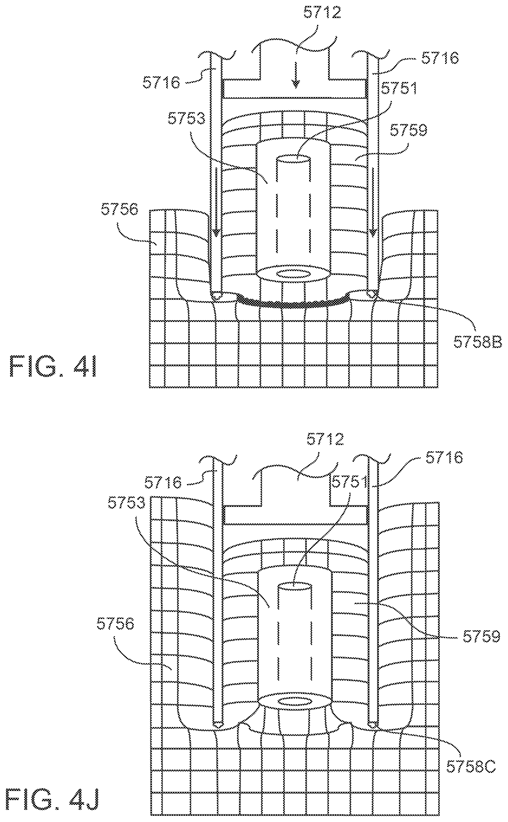 Patent US12297416 Figure 20 – System and method for transferring tissue