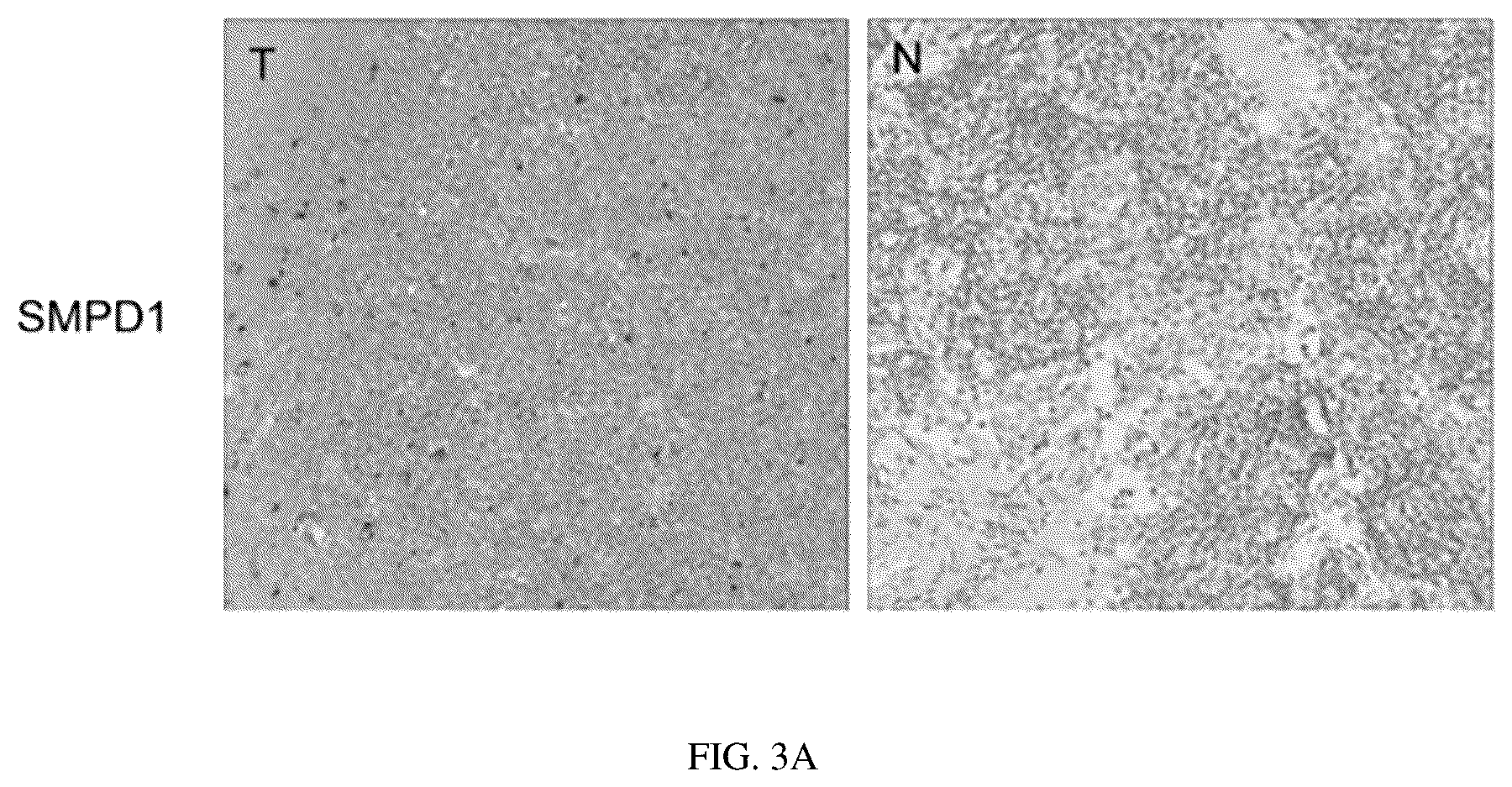 Patent US12297434 Figure 8 – Biomarker for predicting drug resistance of bruton's tyrosine kinase inhibitors and application thereof