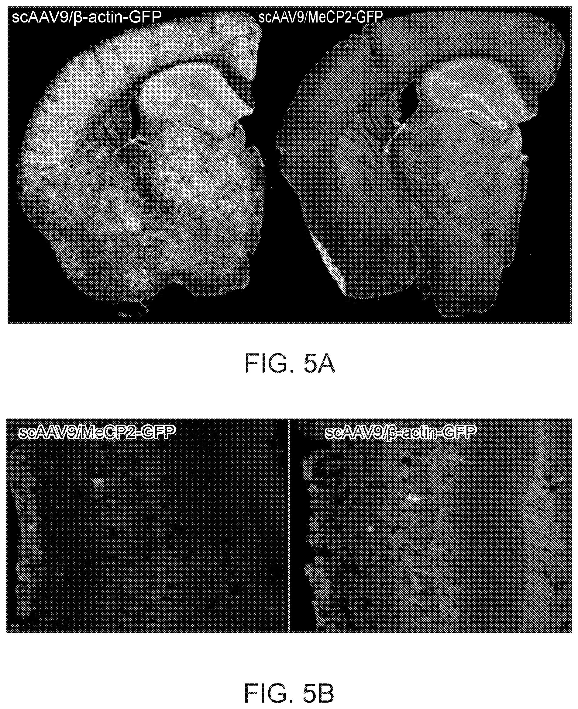Patent US12297447 Figure 10 – Gene therapy for juvenile Batten disease