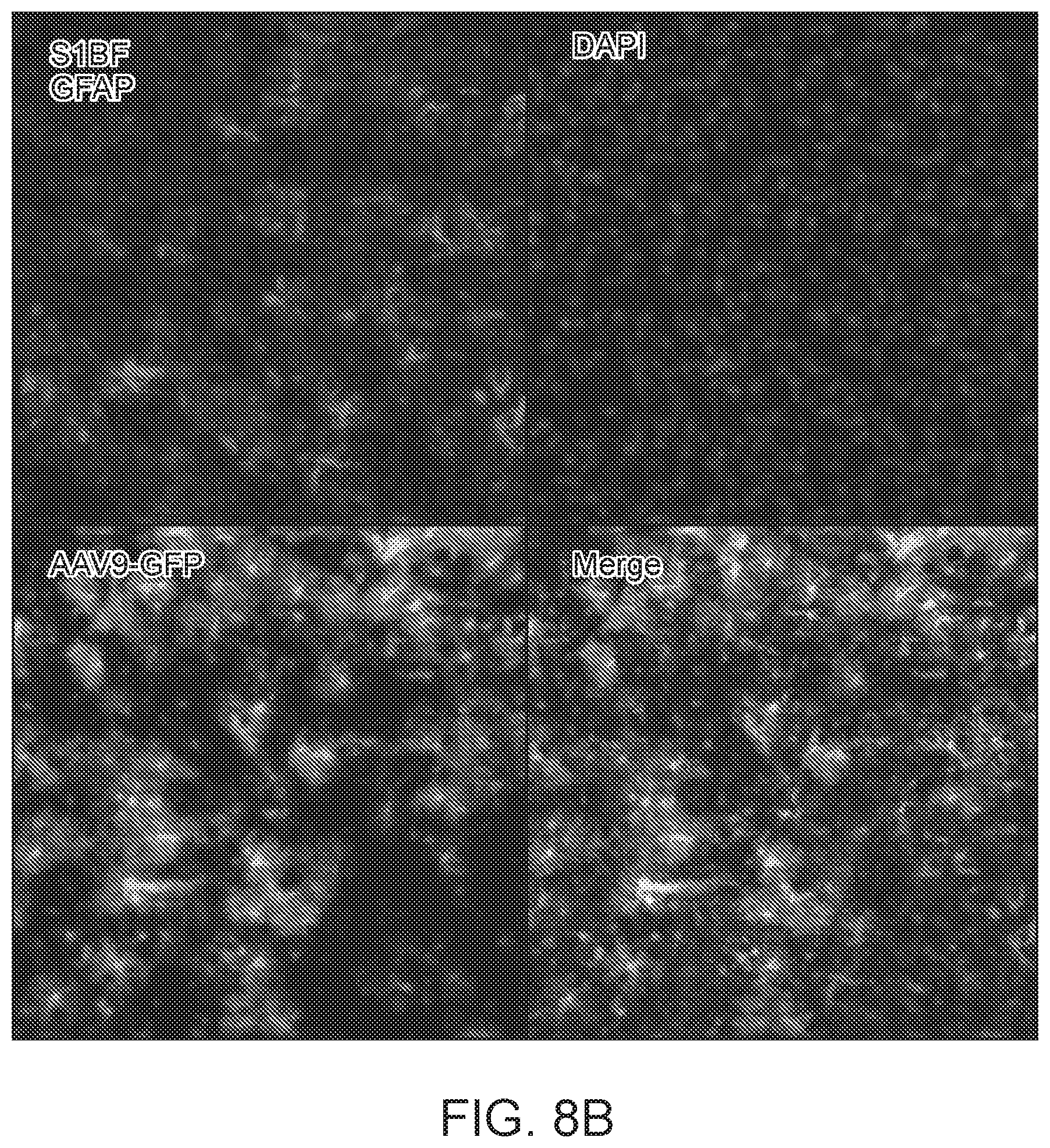 Patent US12297447 Figure 18 – Gene therapy for juvenile Batten disease