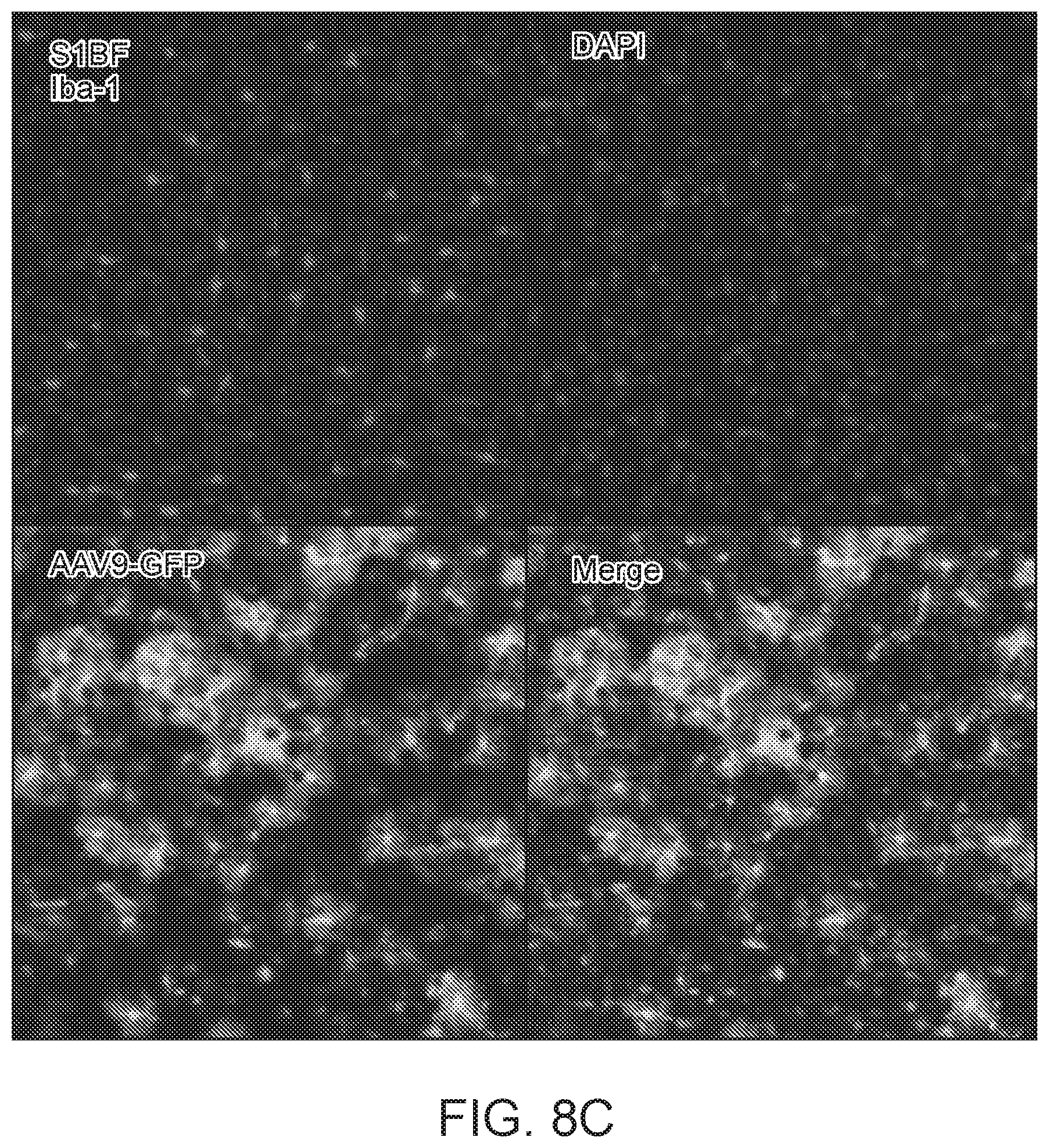 Patent US12297447 Figure 19 – Gene therapy for juvenile Batten disease