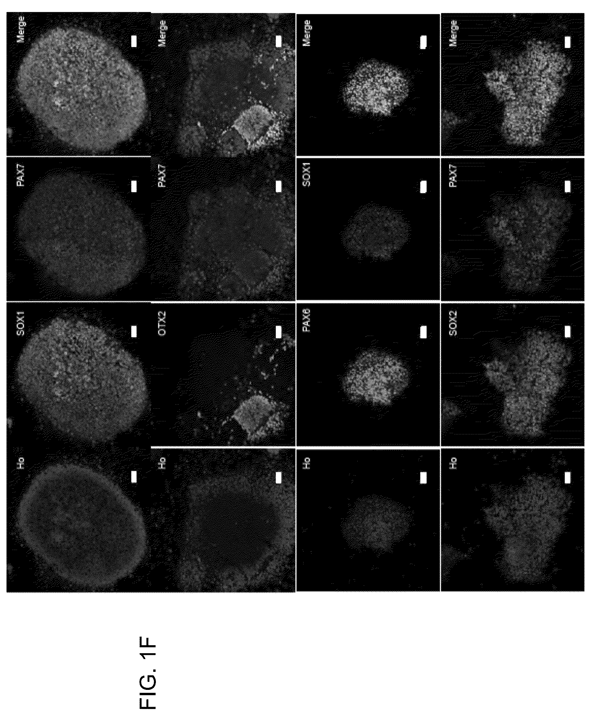 Patent US12297453 Figure 5 – Generation of norepinephrine neurons from human stem cells