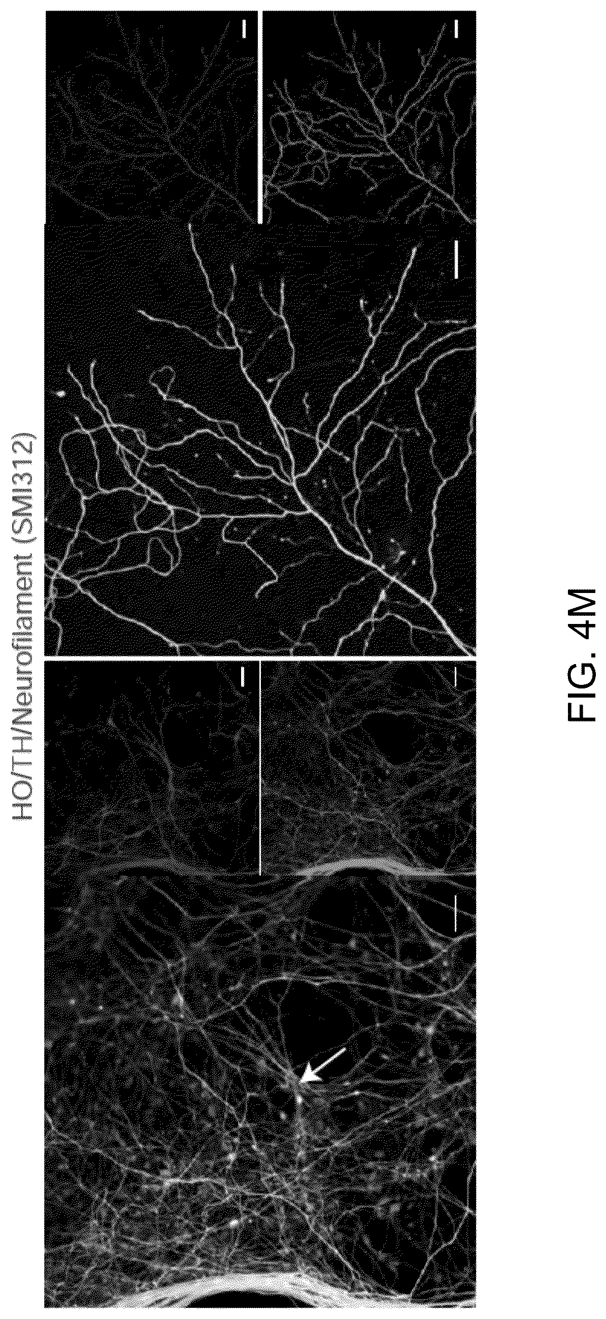 Patent US12297453 Figure 18 – Generation of norepinephrine neurons from human stem cells