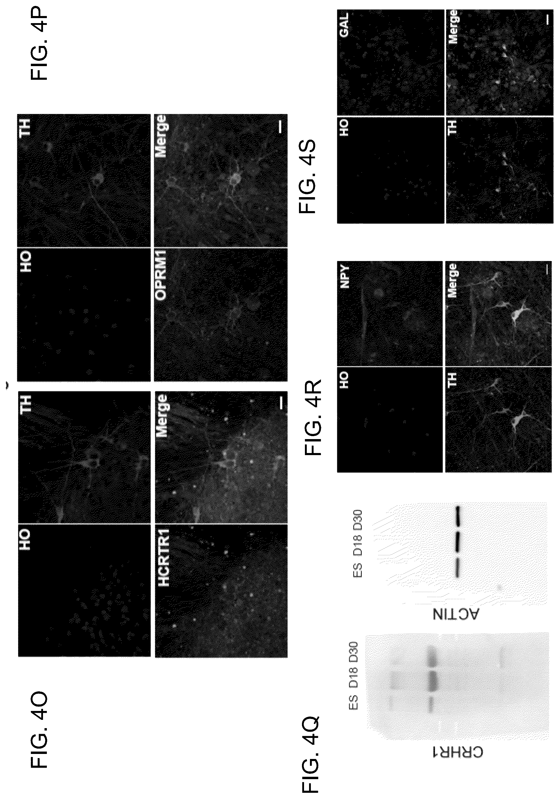 Patent US12297453 Figure 20 – Generation of norepinephrine neurons from human stem cells