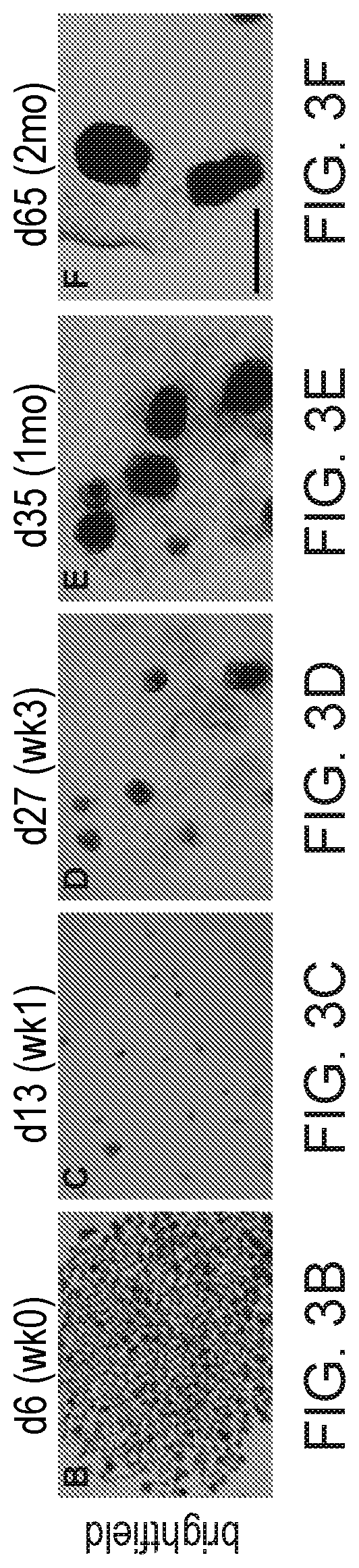 Patent US12297457 Figure 10 – Esophageal tissue and/or organoid compositions and methods of making same