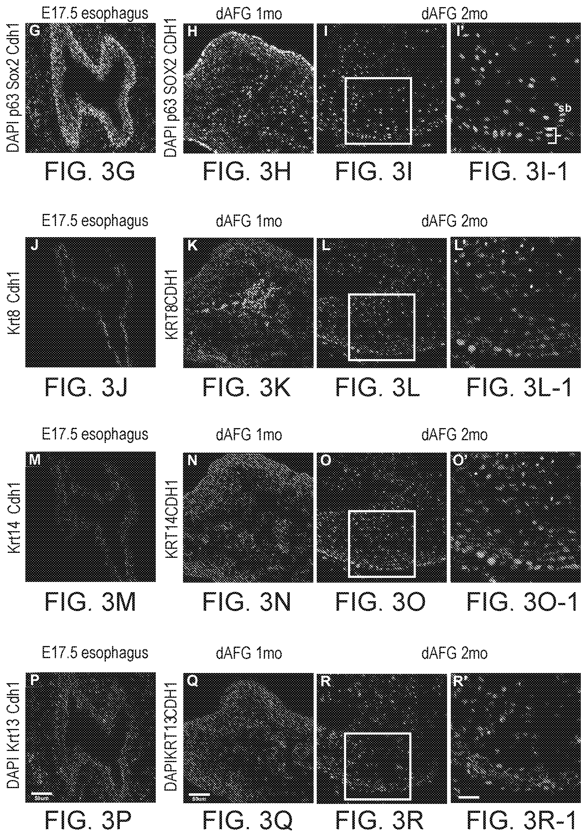 Patent US12297457 Figure 11 – Esophageal tissue and/or organoid compositions and methods of making same