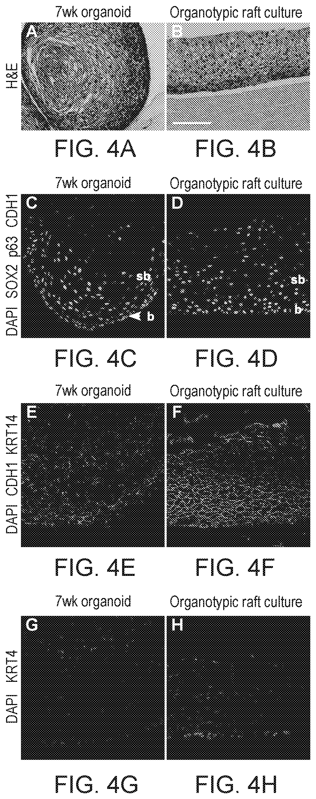Patent US12297457 Figure 16 – Esophageal tissue and/or organoid compositions and methods of making same