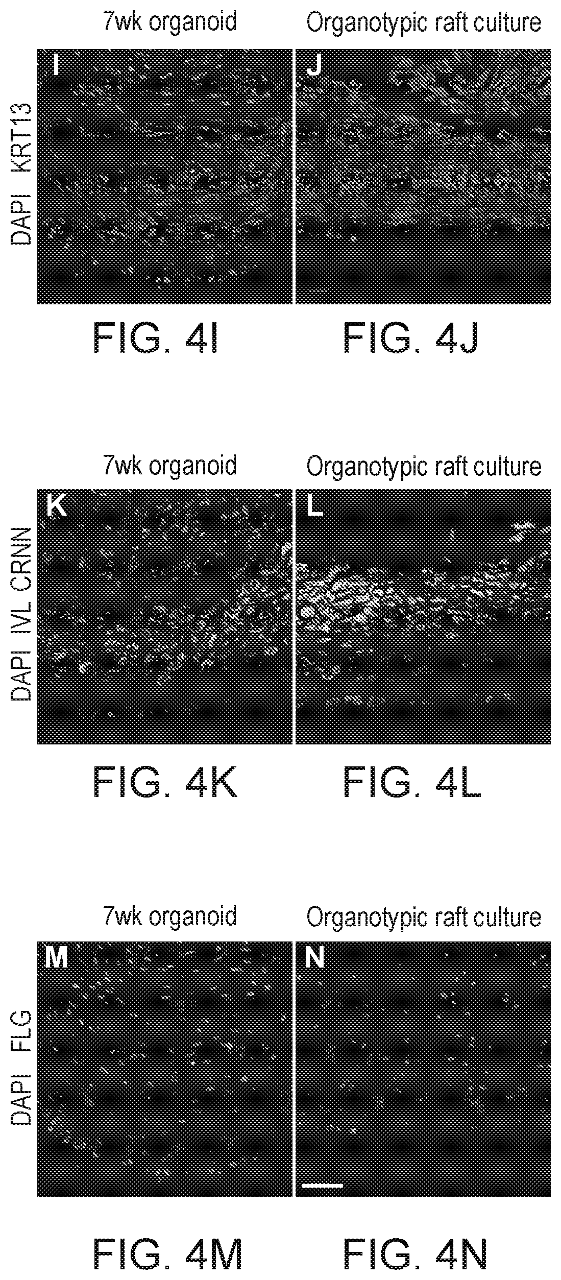 Patent US12297457 Figure 17 – Esophageal tissue and/or organoid compositions and methods of making same