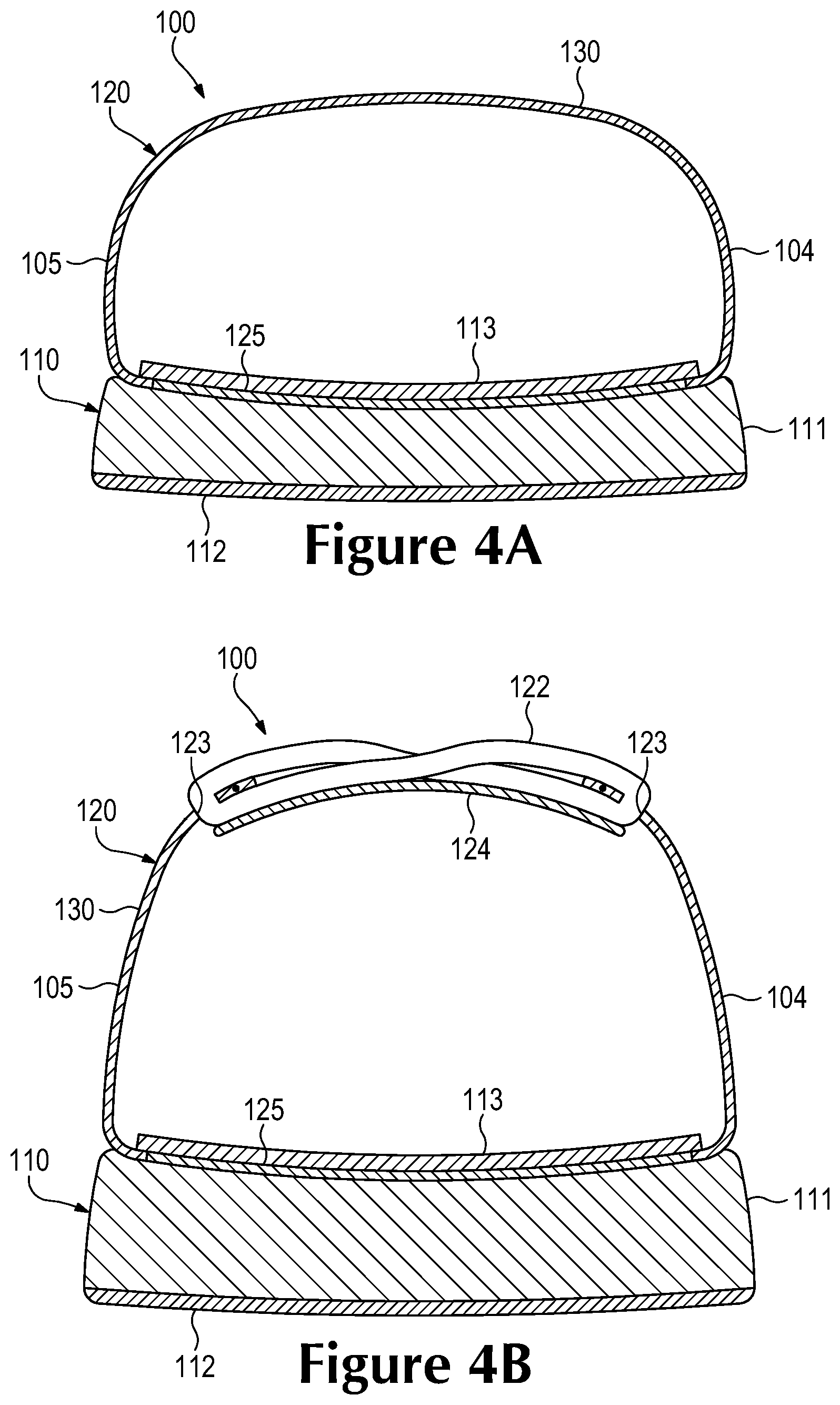 Patent US12297569 Figure 4 – Knitted component and method of manufacturing the same