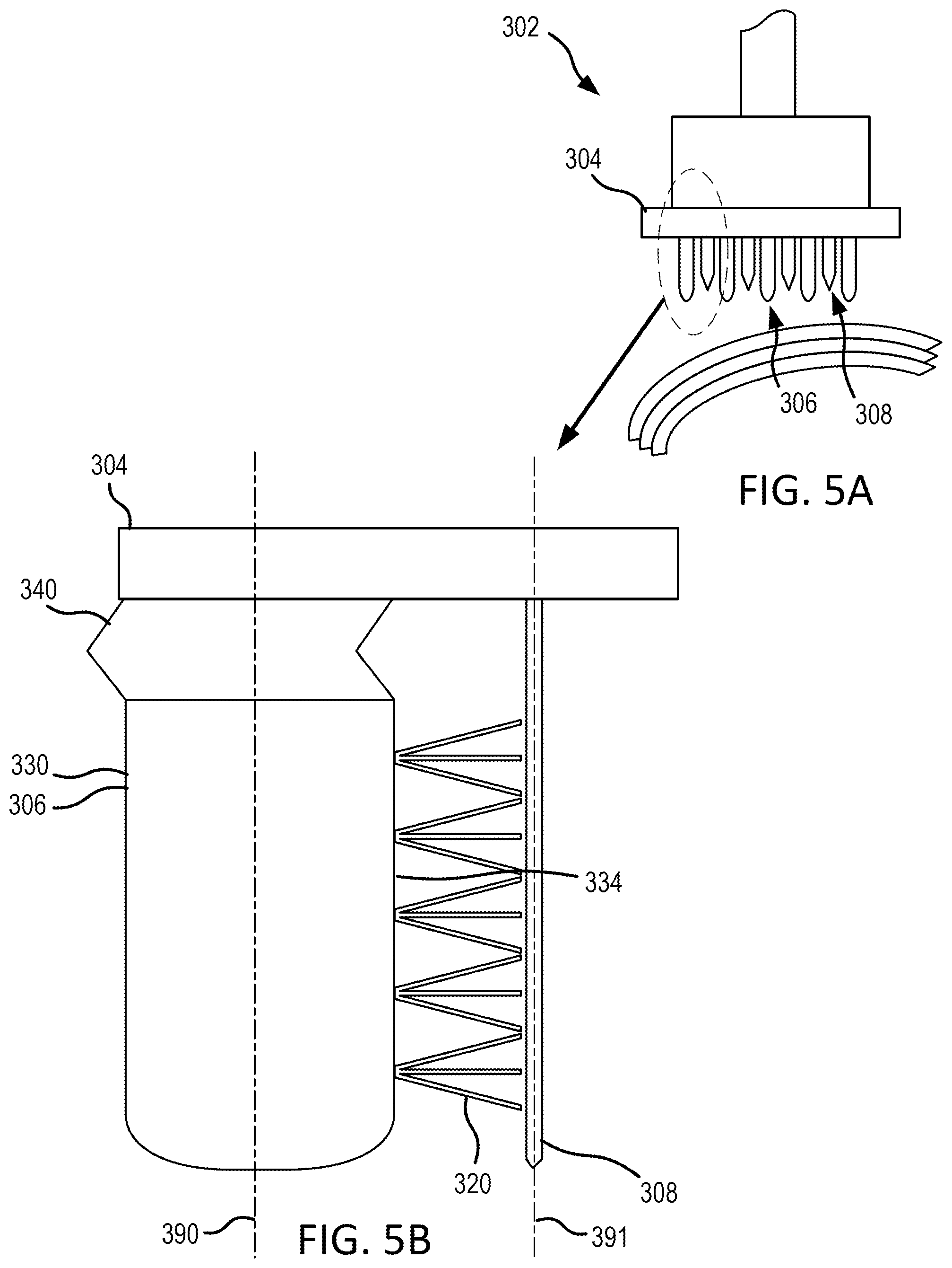 Patent US12297572 Figure 3 – Systems and methods for self-cleaning needles for through thickness reinforcement of resin-infused fabrics