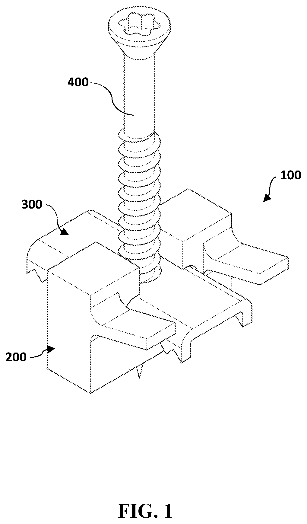 Patent US12297649 Figure 1 – Deck clip