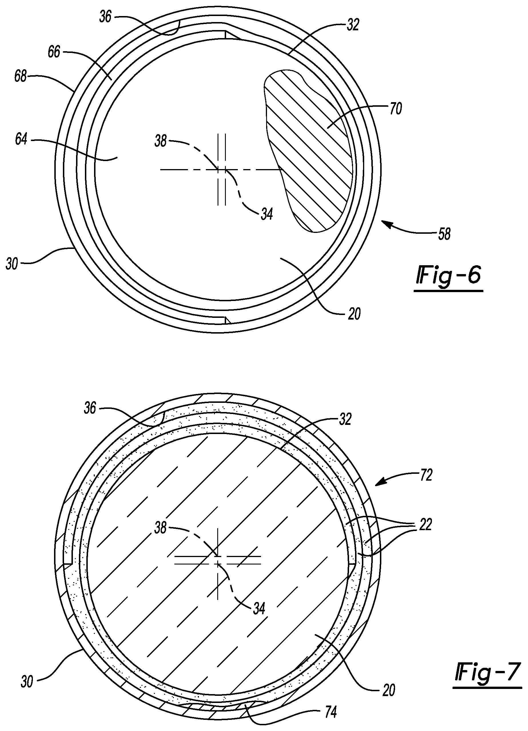 Patent US12297761 Figure 3 – Exhaust system component with multi-layer support mat