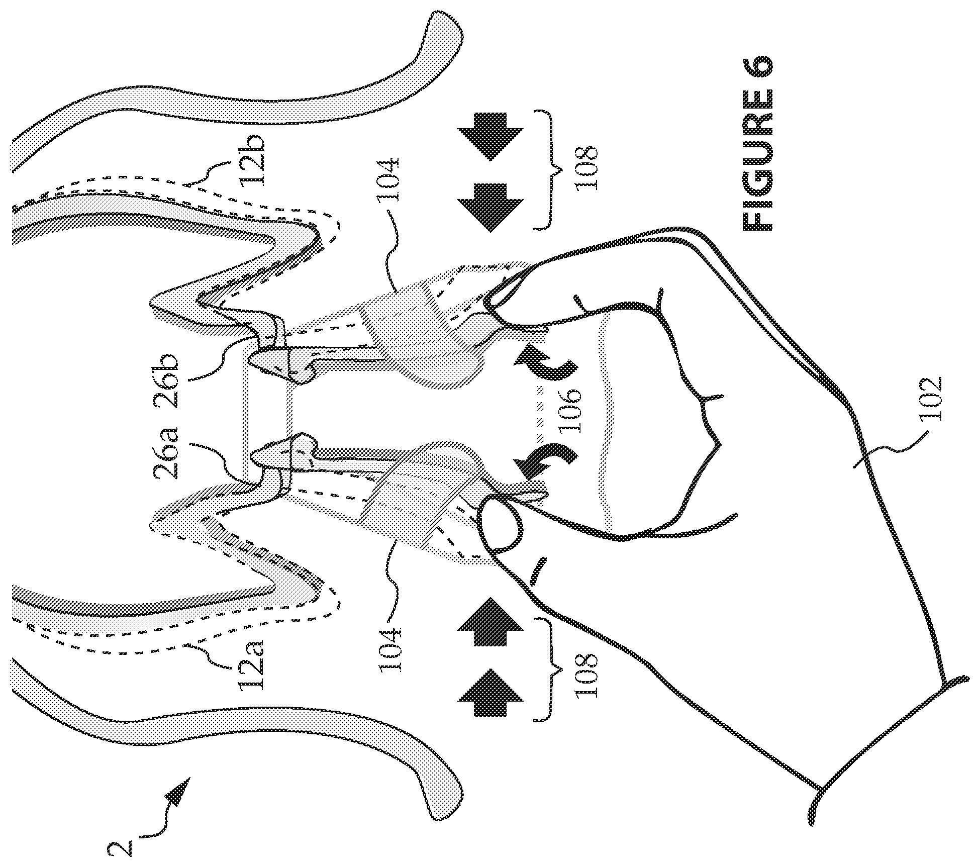 Patent US12302863 Figure 6 – Quick attach/detach form-fitting pet potty handle with rapid-deploy/disposable waste receptacle/bag and method for using same