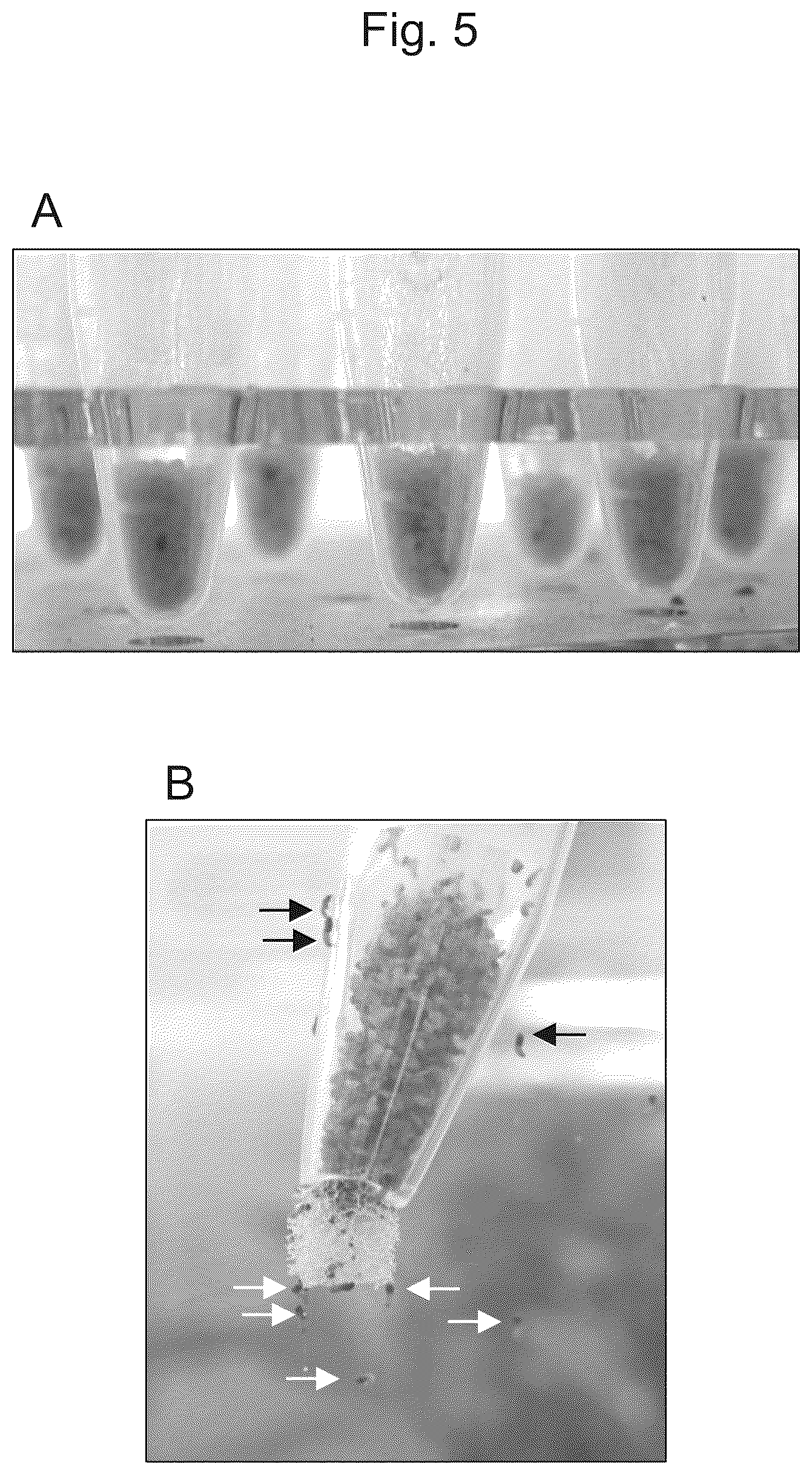 Patent US12302875 Figure 5 – Egg collection device for bagworm moth and breeding method and egg collection method of bagworm moth using the same