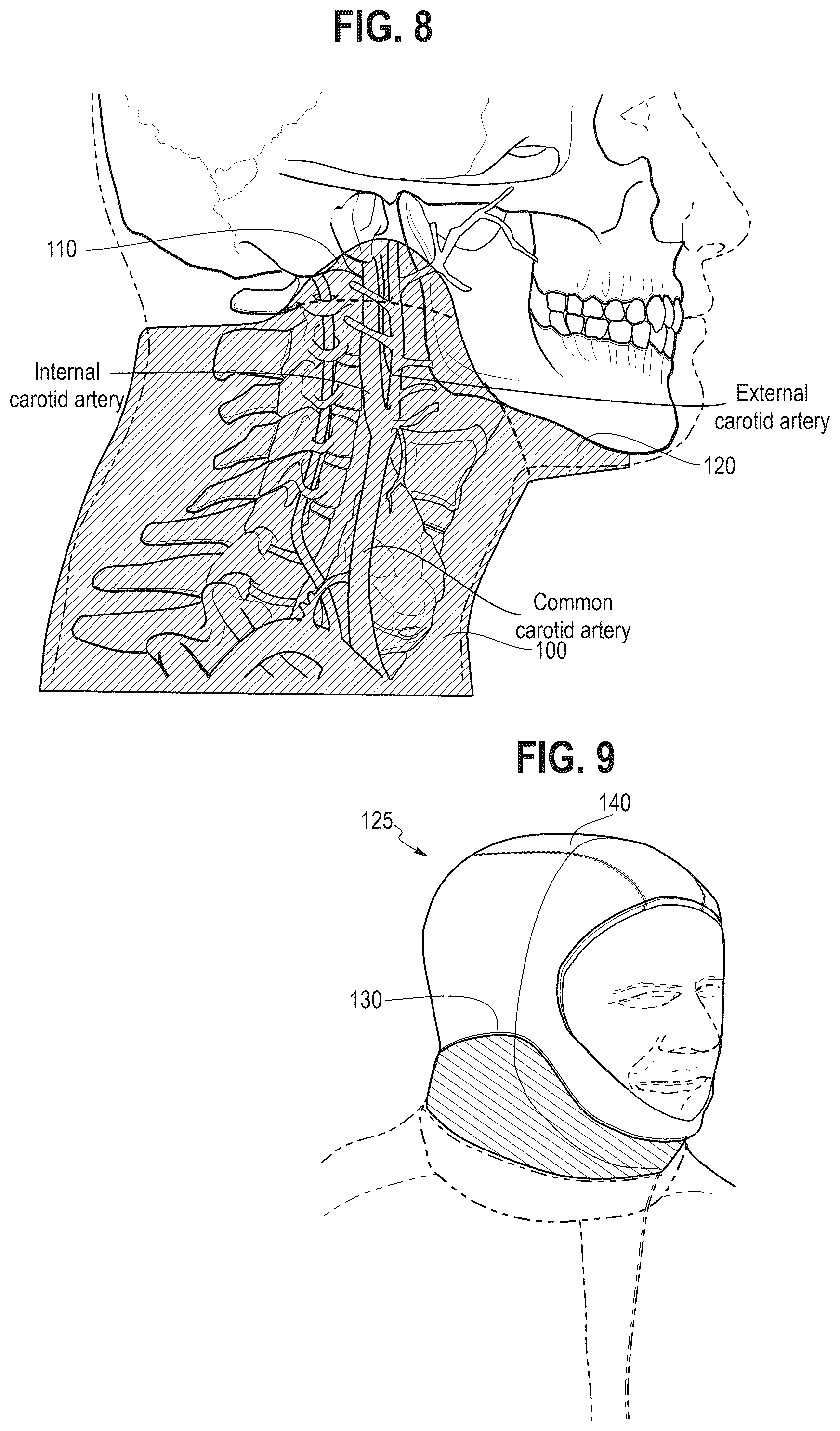 Patent US12302959 Figure 5 – Neck laceration prevention device
