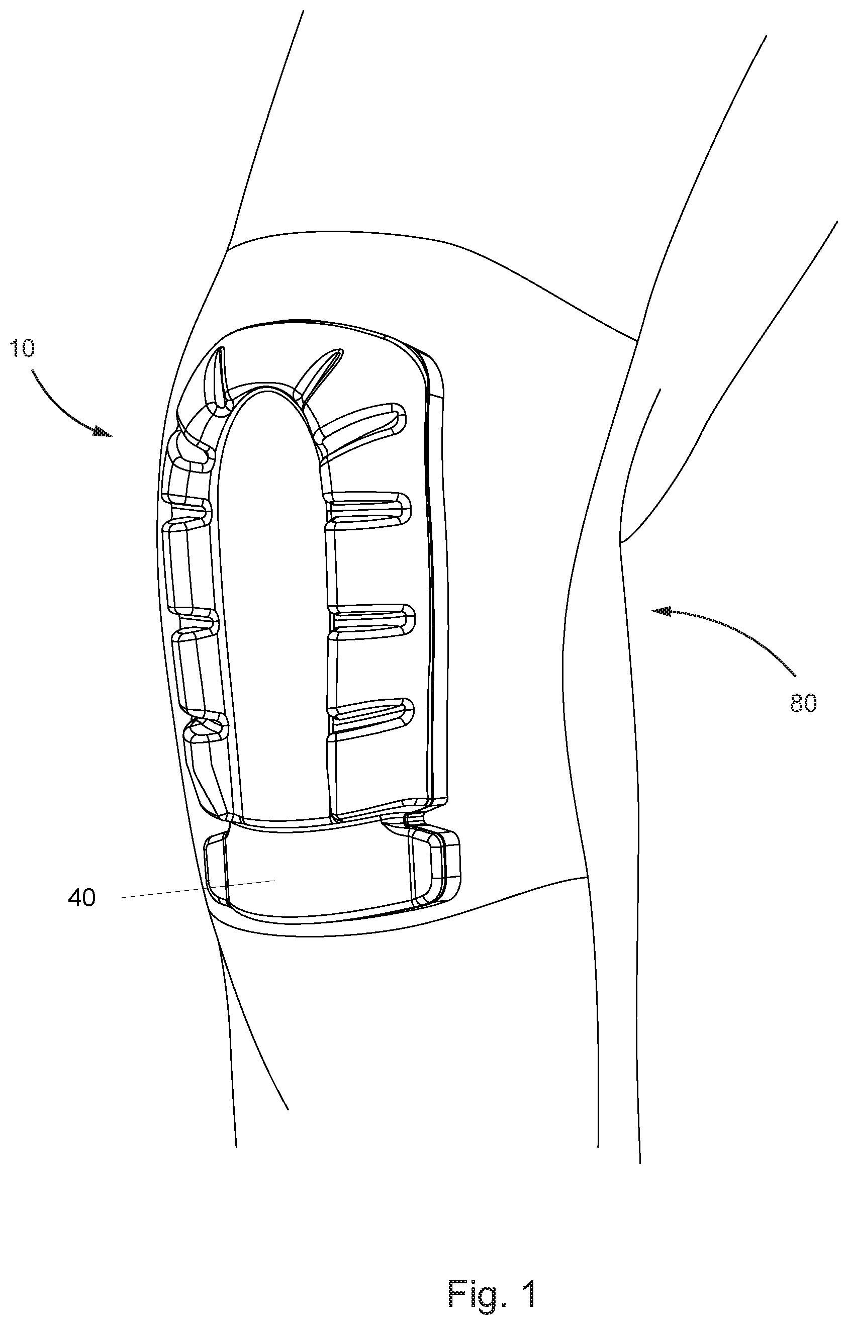 Patent US12302960 — Body part pad — Figure 1