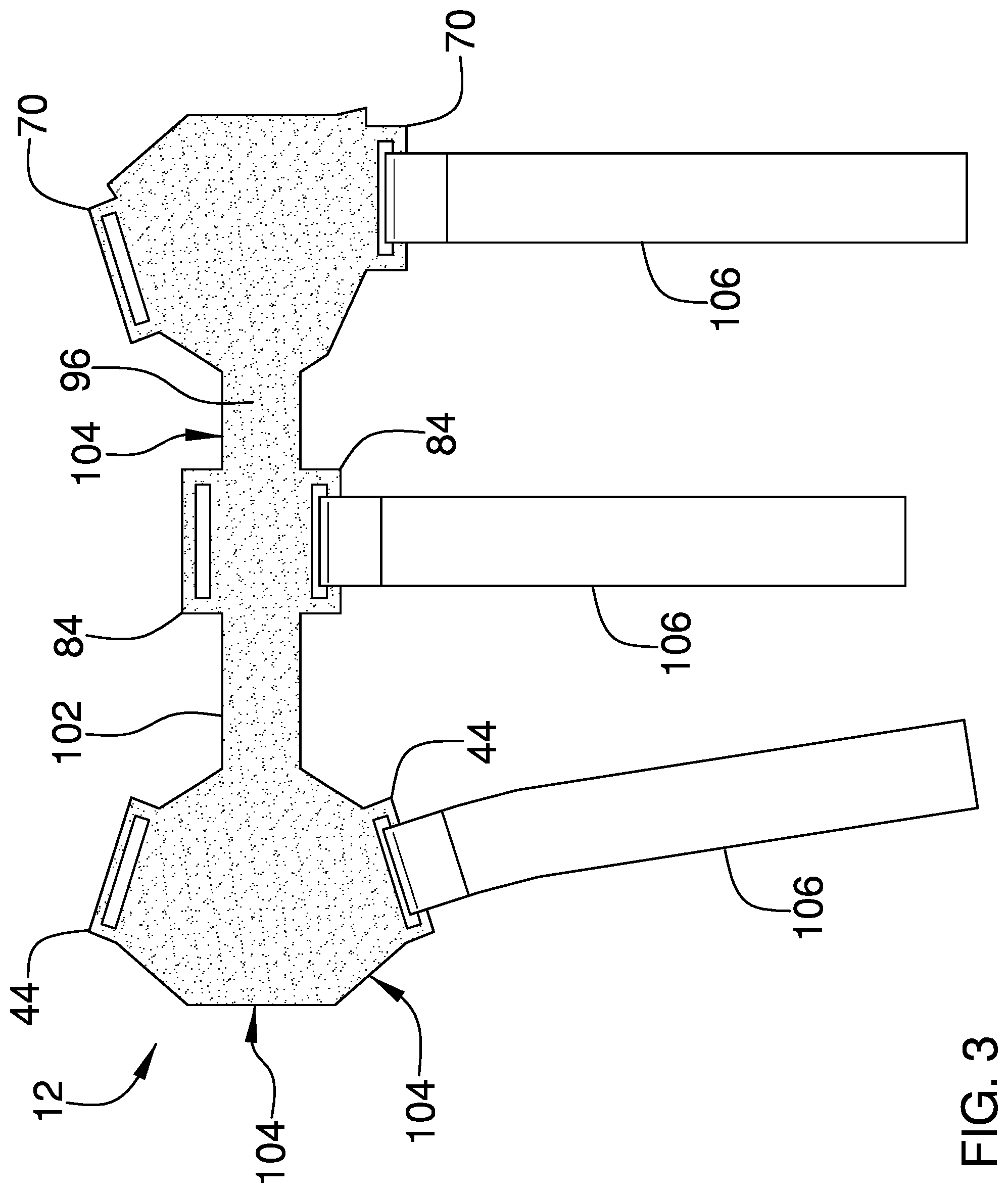 Patent US12302961 Figure 3 – Bowling wrist brace device