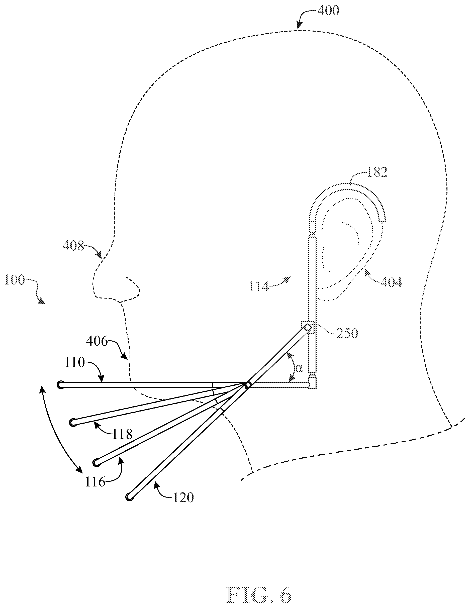 Patent US12302963 Figure 5 – Cage-like face mask