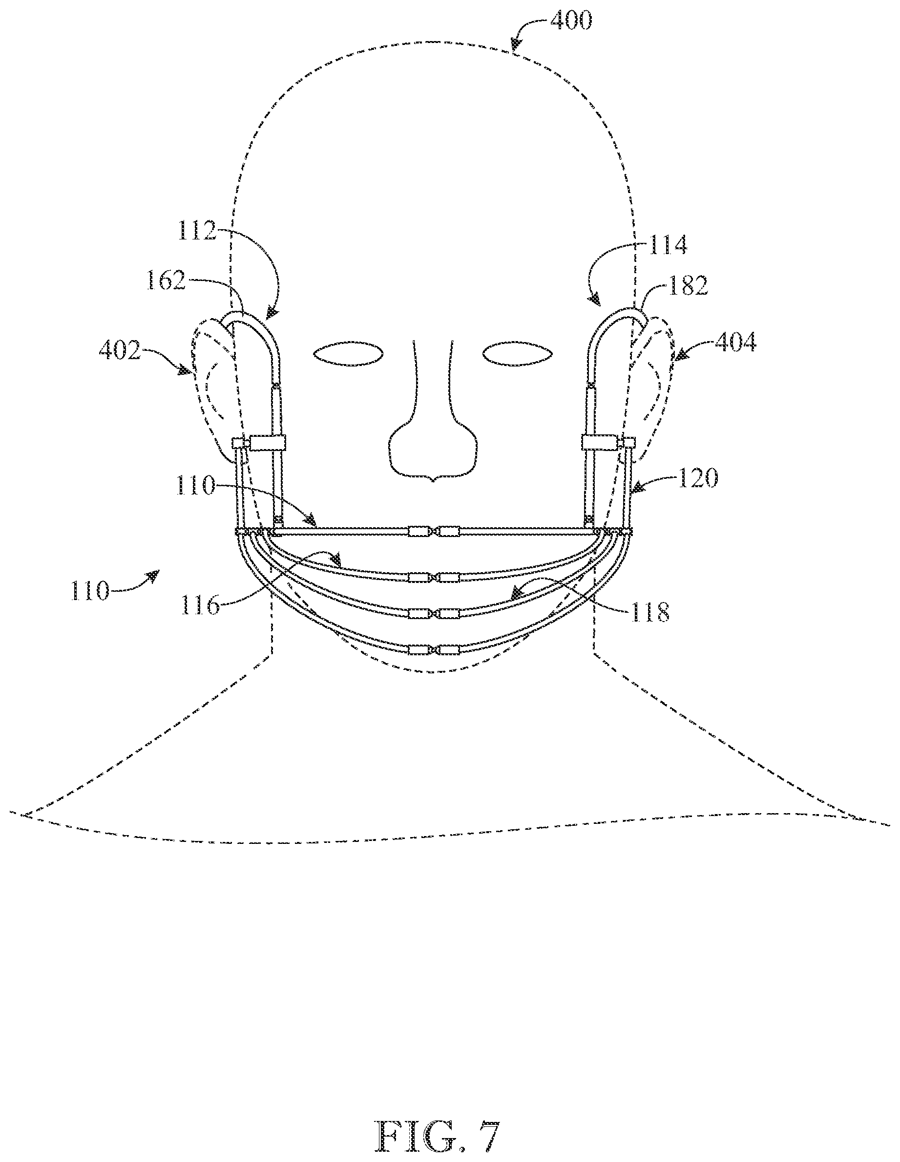 Patent US12302963 Figure 6 – Cage-like face mask