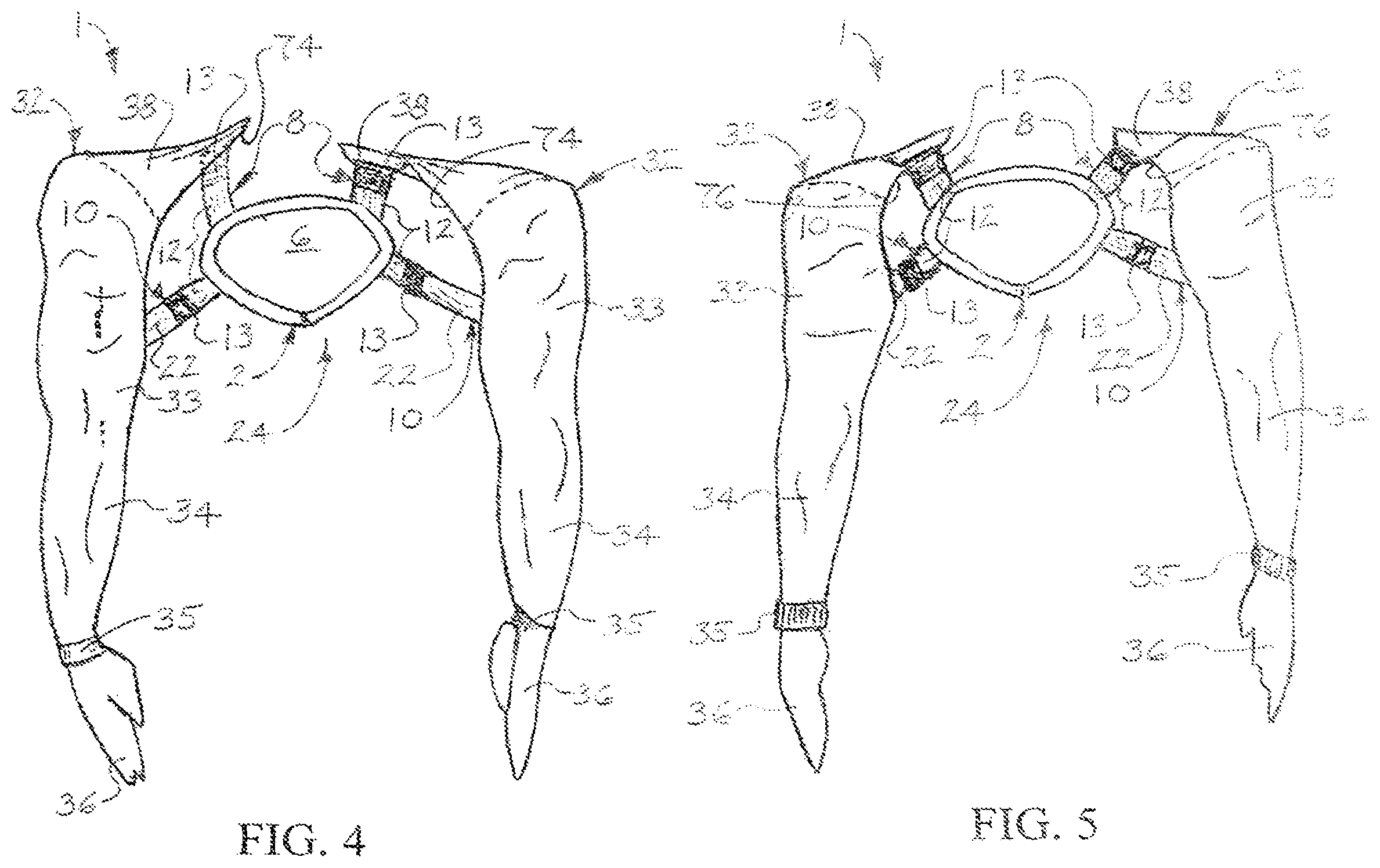 Patent US12302968 Figure 2 – Sleeve garment assemblies