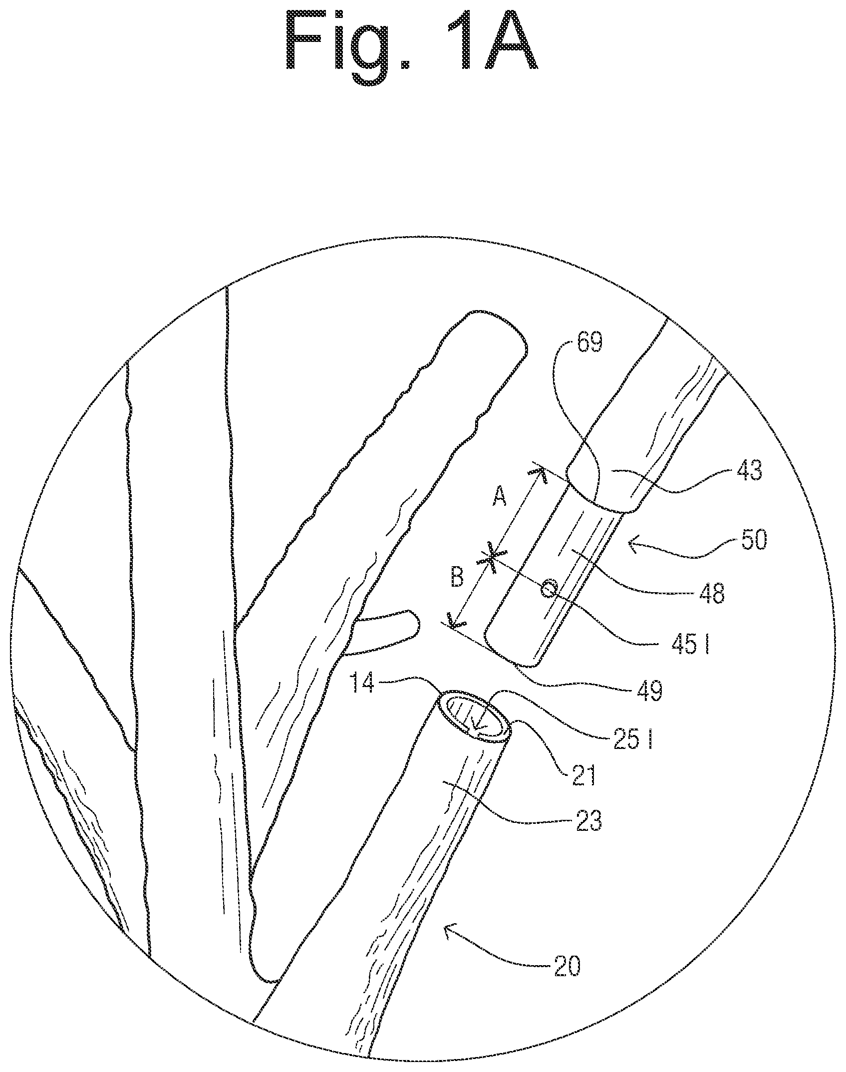 Patent US12302970 Figure 2 – Decorative tree with insertable, interchangeable branches system and method