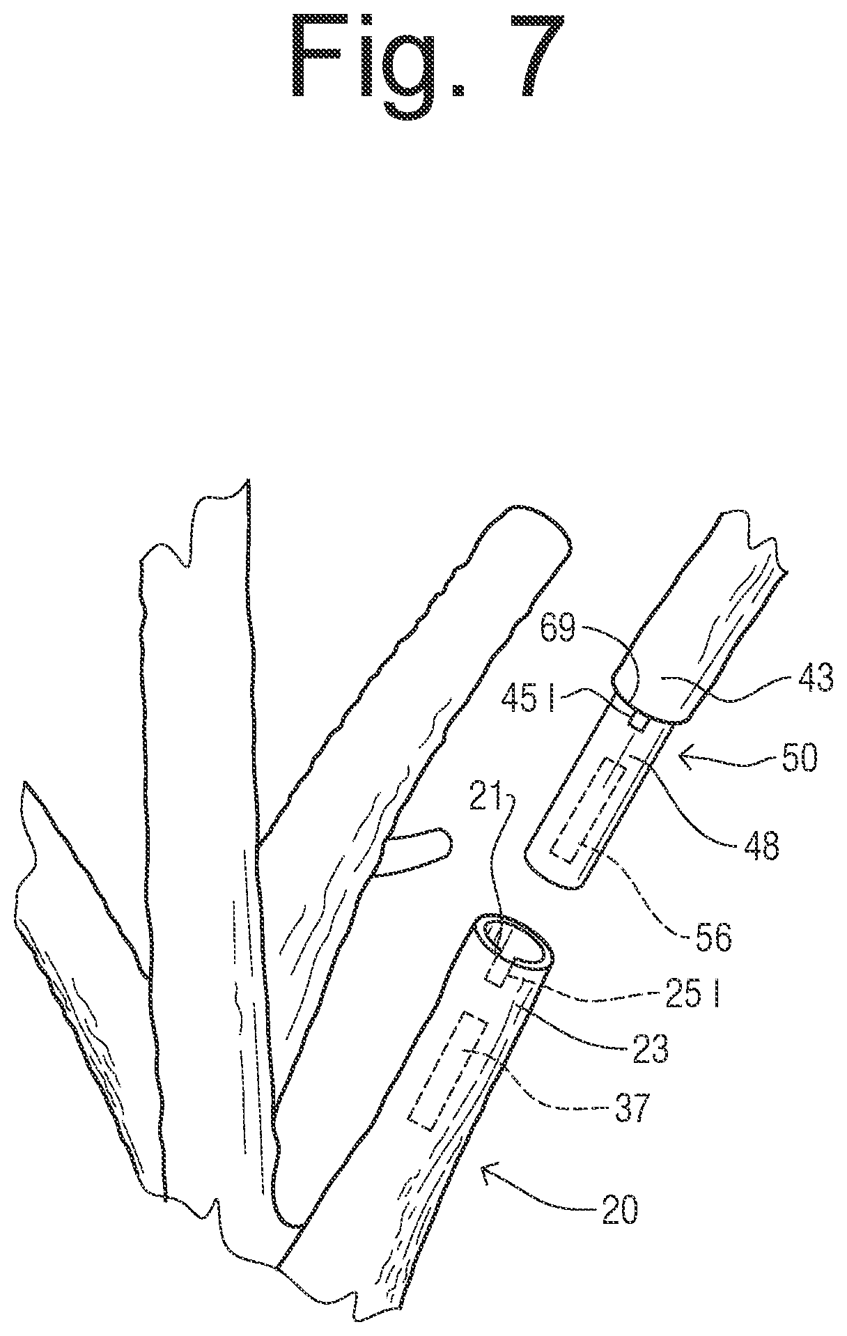 Patent US12302970 Figure 6 – Decorative tree with insertable, interchangeable branches system and method