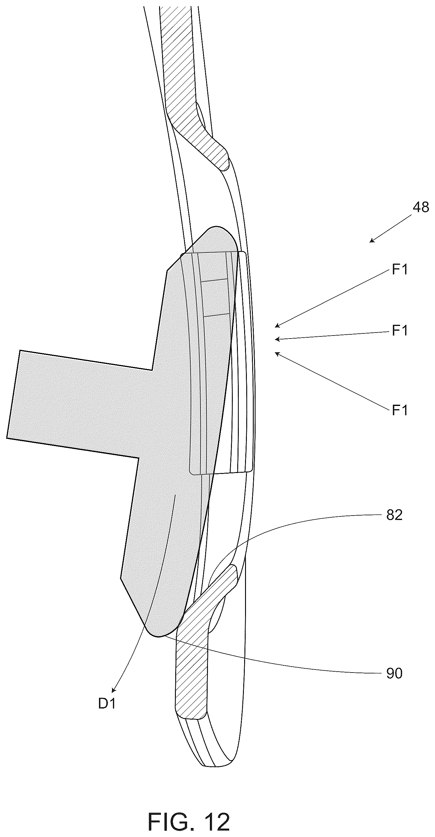 Patent US12302978 Figure 9 – Breakaway visor