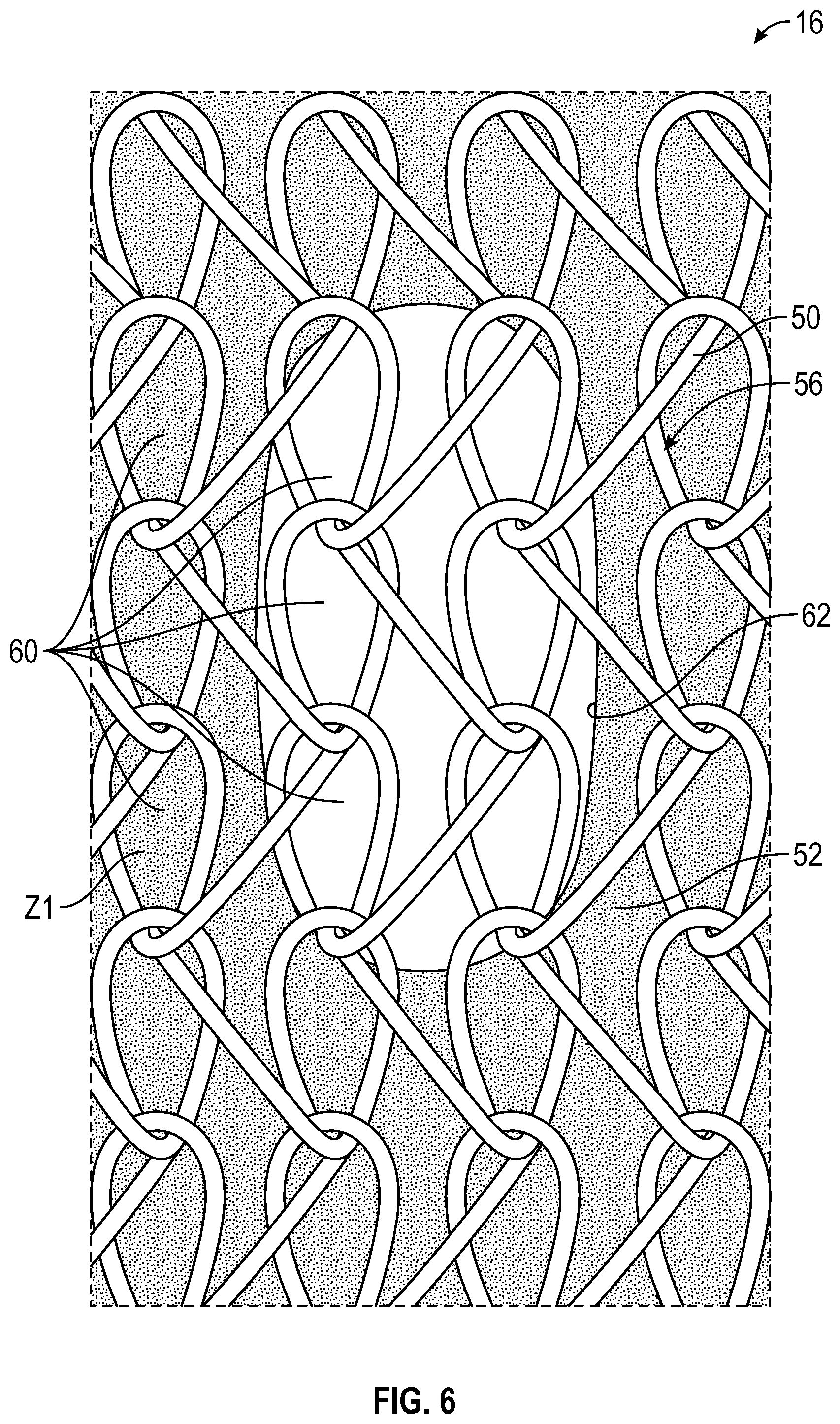 Patent US12302979 Figure 6 – Footwear upper having a unitary knit structure and method of manufacturing
