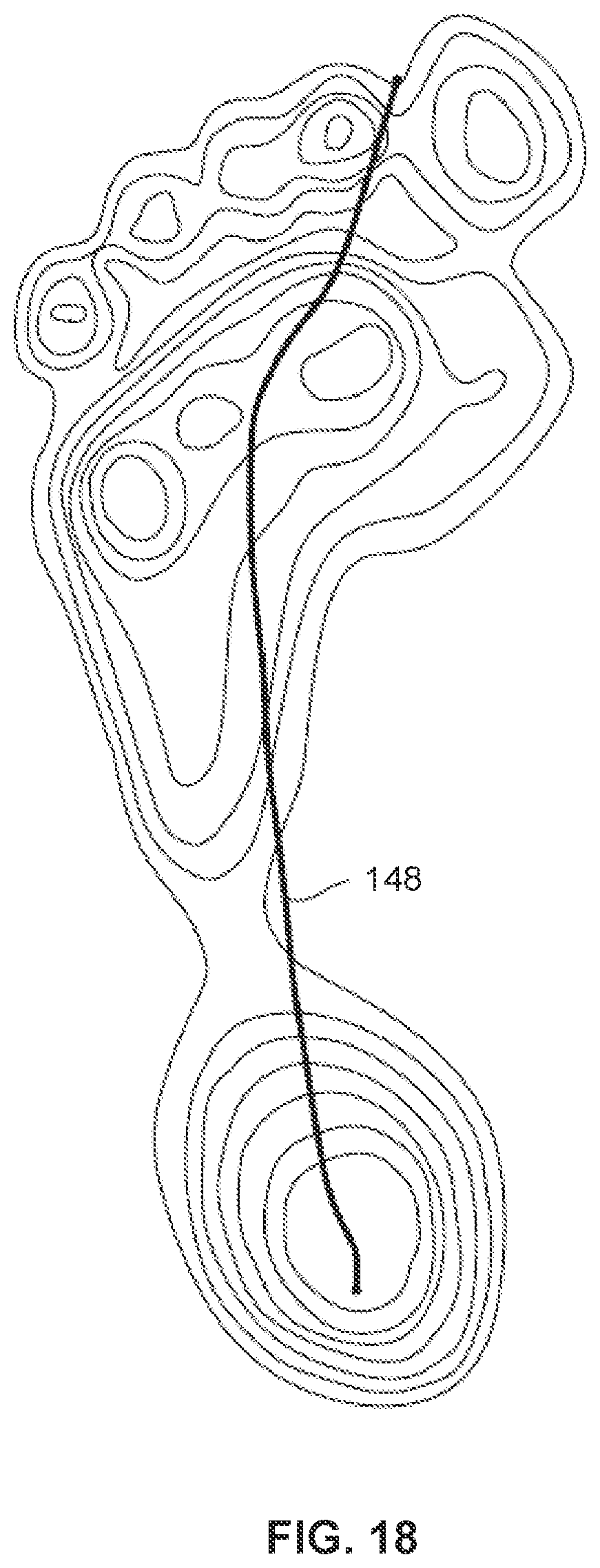 Patent US12302994 Figure 15 – Outsole pattern for an article of footwear