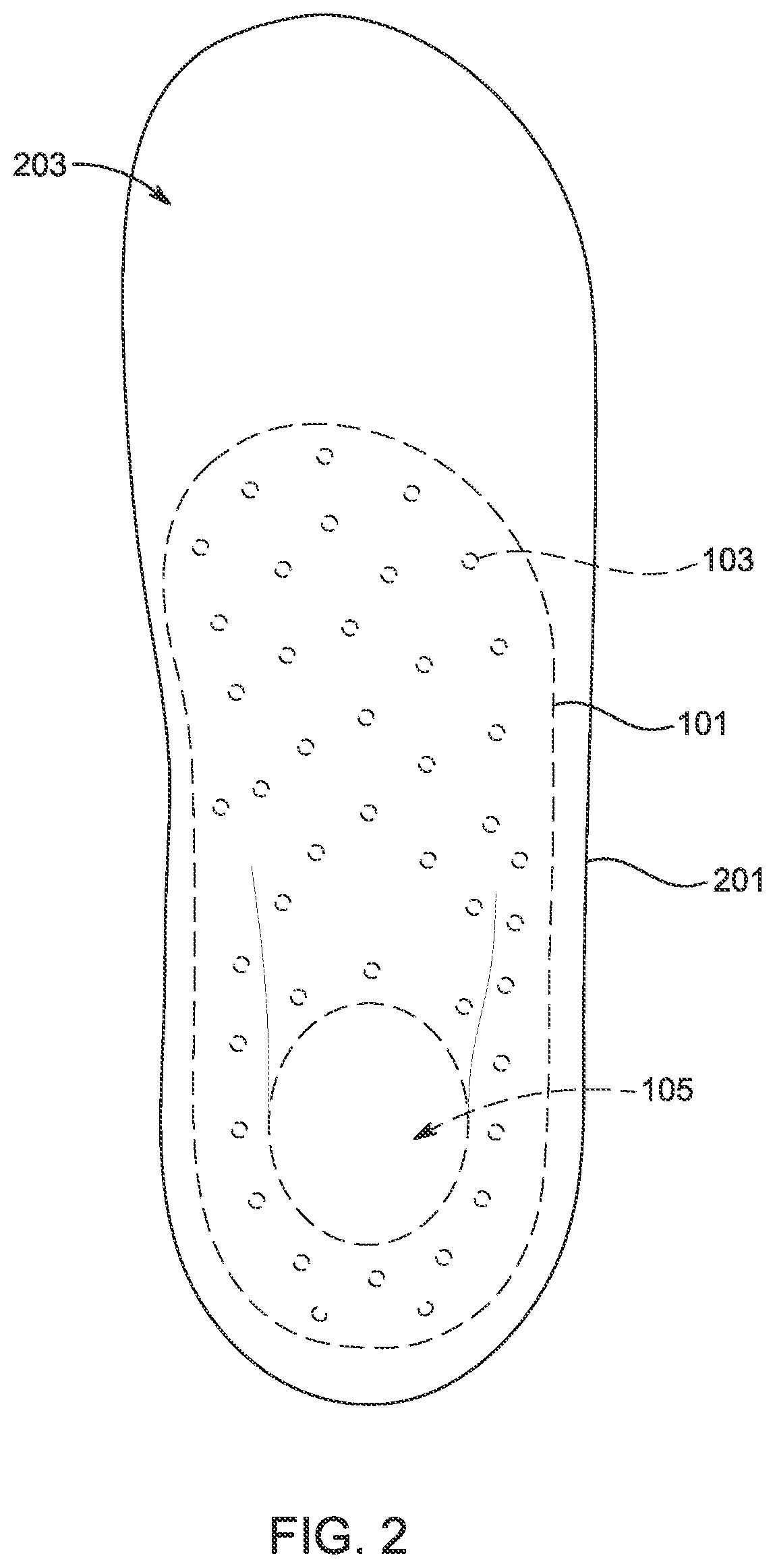 Patent US12302997 Figure 2 – Method of producing a custom orthotic insole