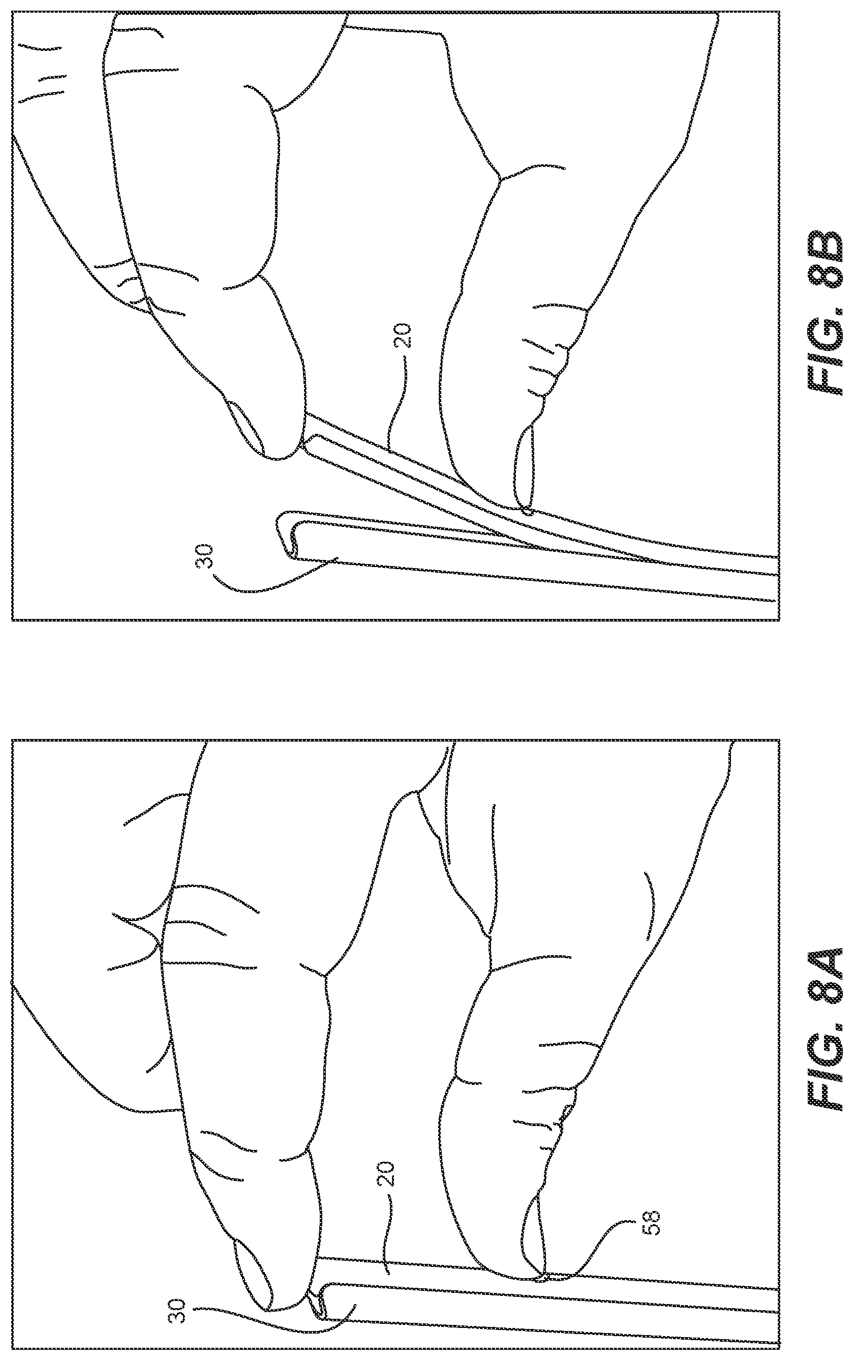 Patent US12303049 Figure 10 – Straw