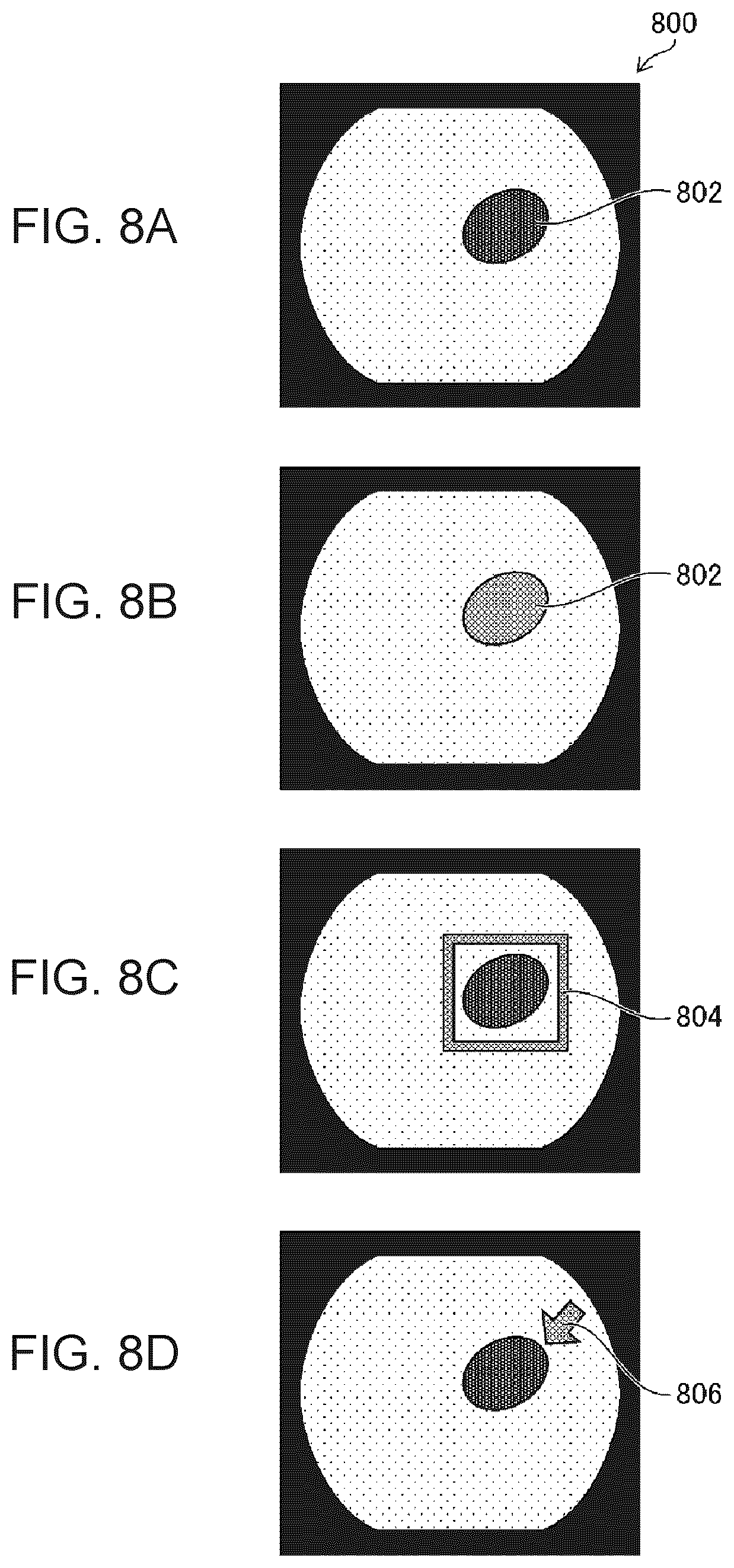 Patent US12303097 Figure 7 – Medical image processing apparatus, endoscope system, and medical image processing method