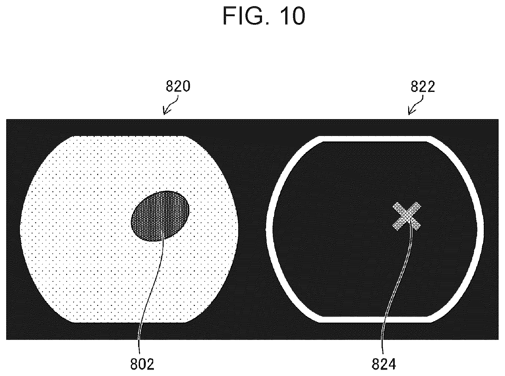 Patent US12303097 Figure 9 – Medical image processing apparatus, endoscope system, and medical image processing method