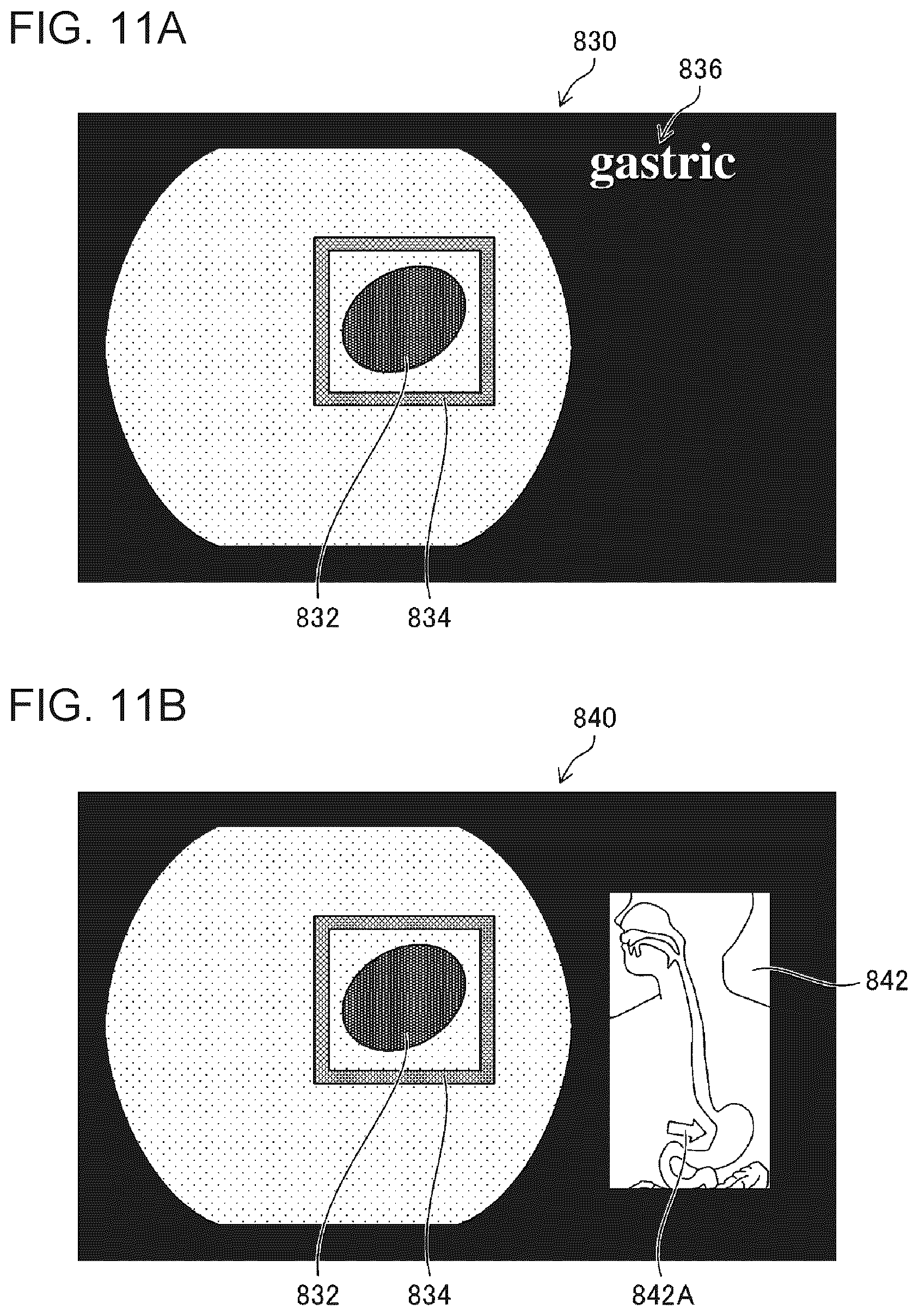 Patent US12303097 Figure 10 – Medical image processing apparatus, endoscope system, and medical image processing method