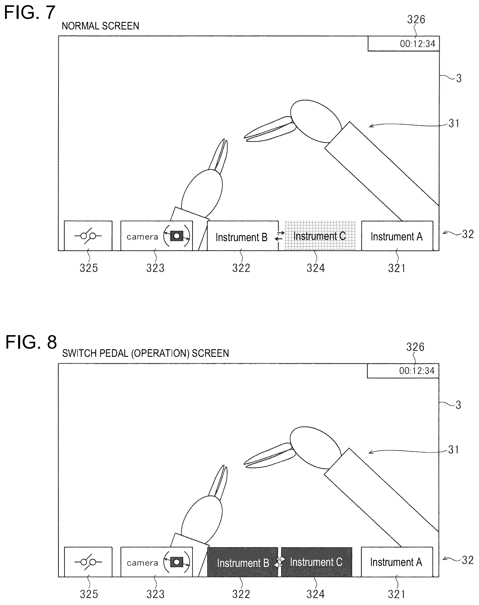 Patent US12303099 Figure 6 – Surgical system and method of displaying information in the same