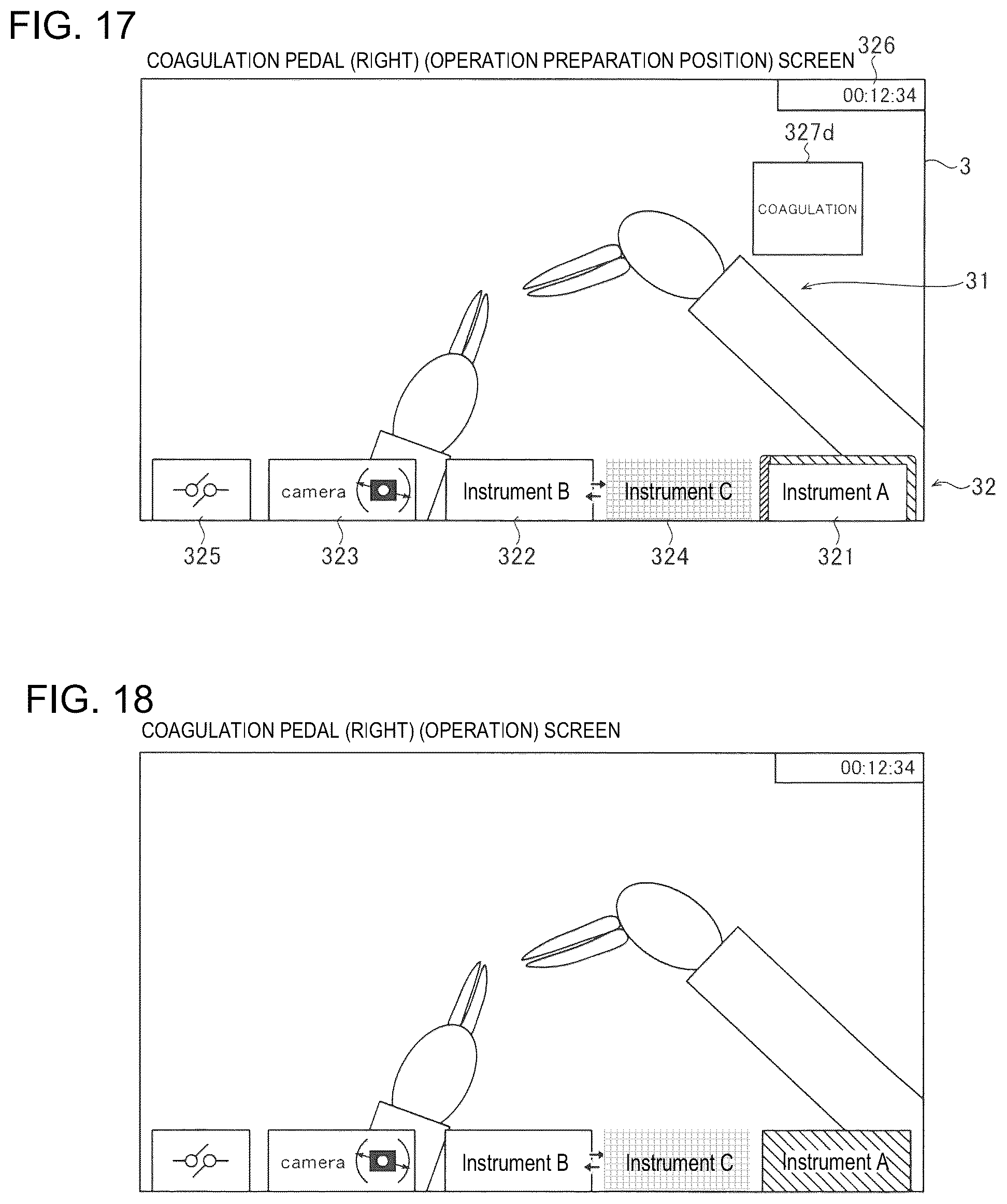 Patent US12303099 Figure 11 – Surgical system and method of displaying information in the same