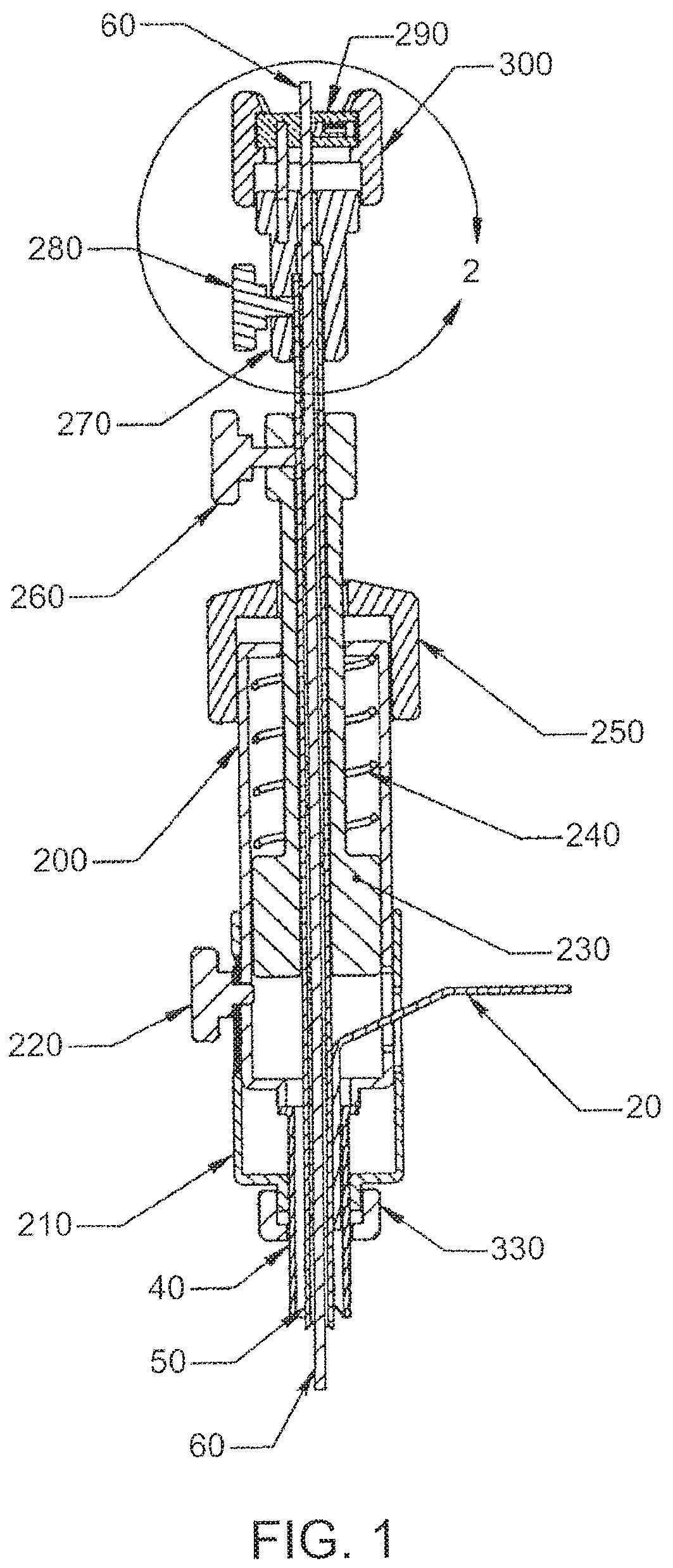 Patent US12303105 Figure 1 – Luminal structure anchoring devices and methods