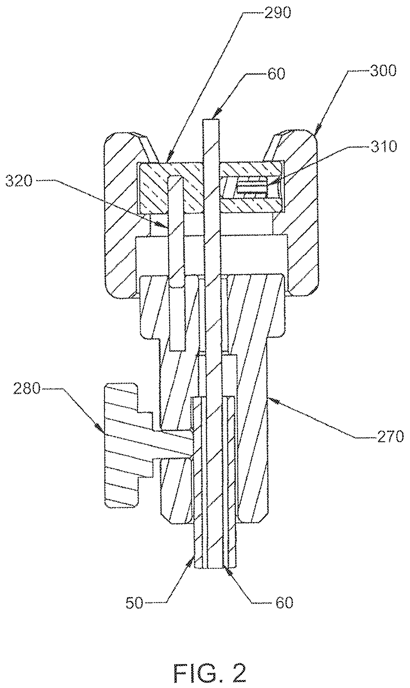 Patent US12303105 Figure 2 – Luminal structure anchoring devices and methods