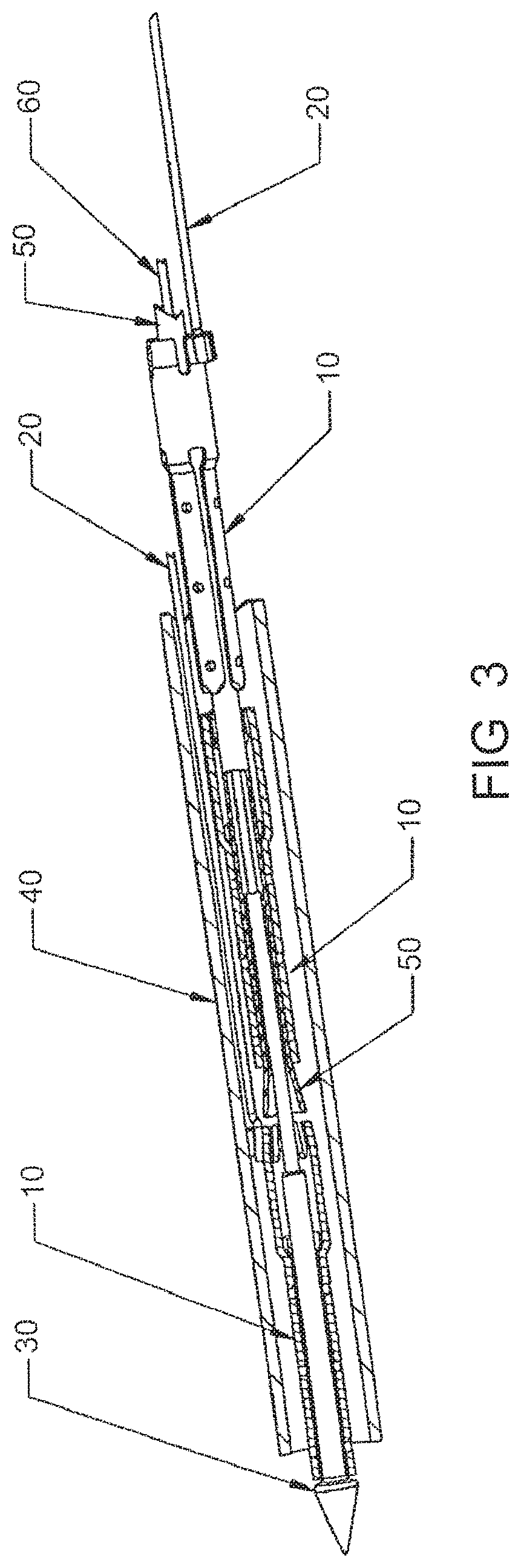 Patent US12303105 Figure 3 – Luminal structure anchoring devices and methods