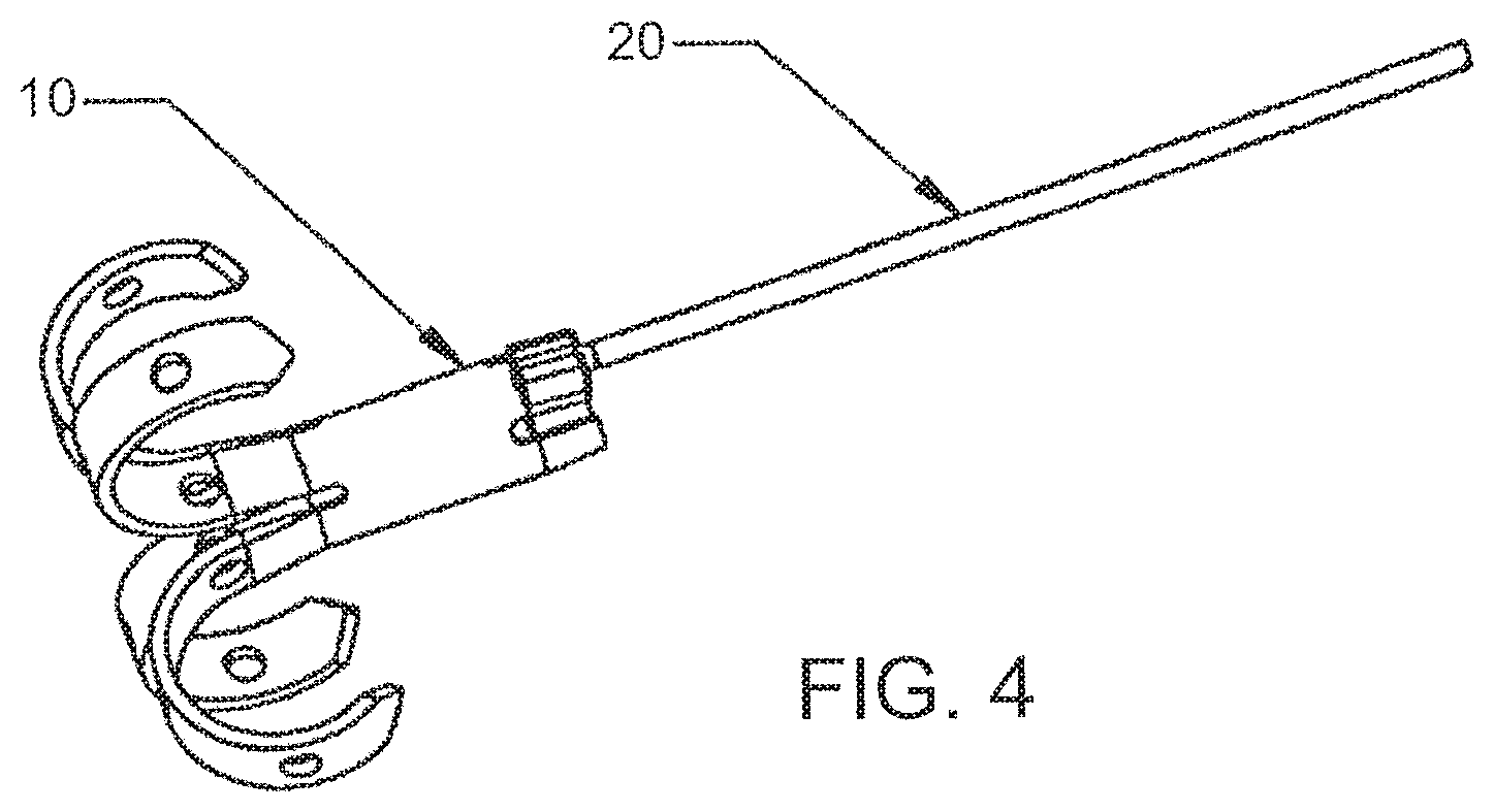 Patent US12303105 Figure 4 – Luminal structure anchoring devices and methods
