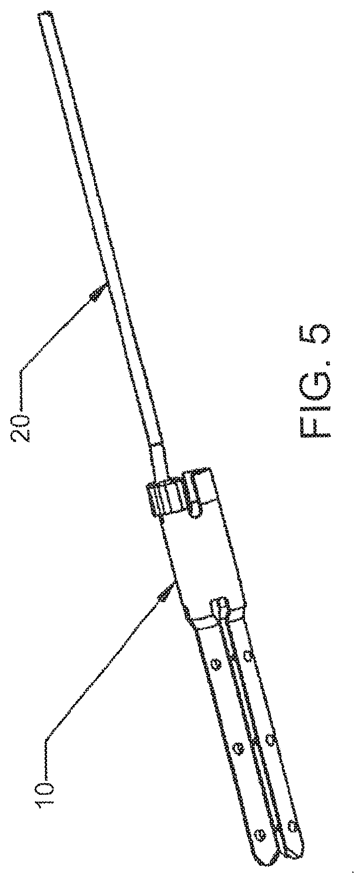 Patent US12303105 Figure 5 – Luminal structure anchoring devices and methods