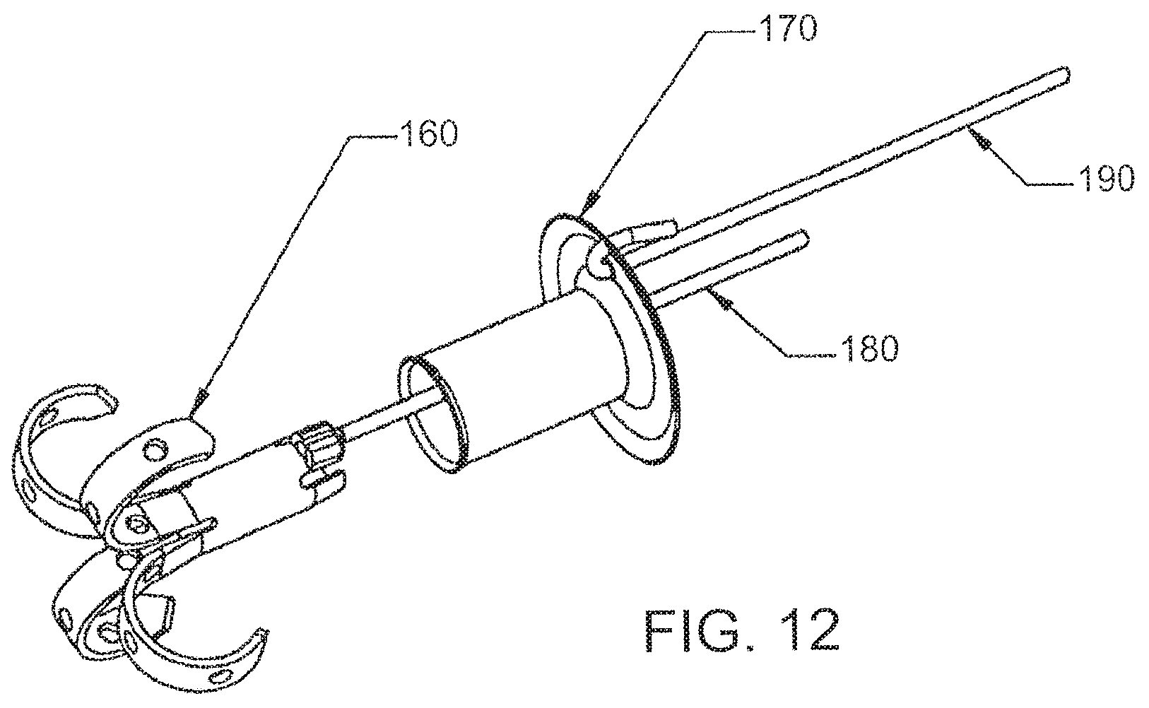 Patent US12303105 Figure 12 – Luminal structure anchoring devices and methods