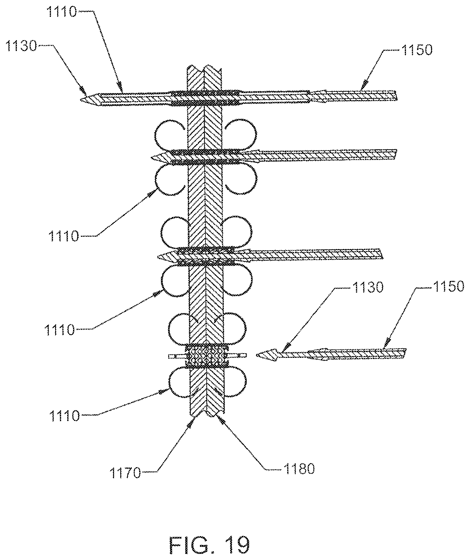 Patent US12303105 Figure 19 – Luminal structure anchoring devices and methods
