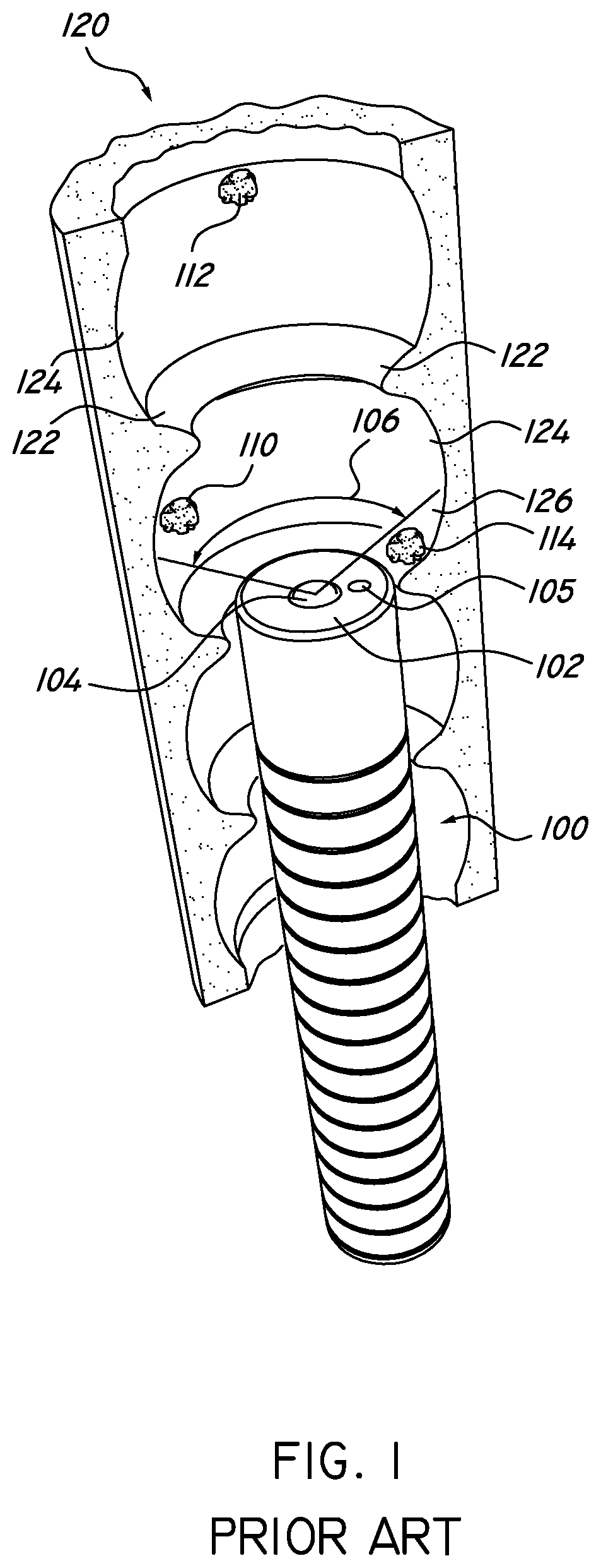 Patent US12303106 Figure 1 – Multi-camera endoscope