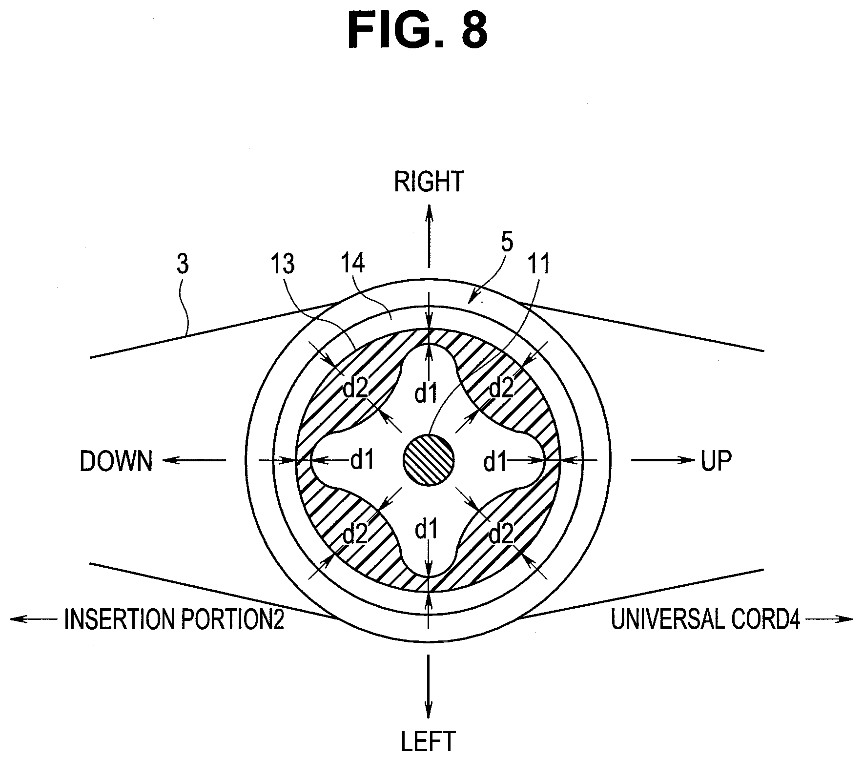 Patent US12303107 Figure 5 – Insertion device having operation lever more easily bendable in predetermined direction and operation portion of insertion device