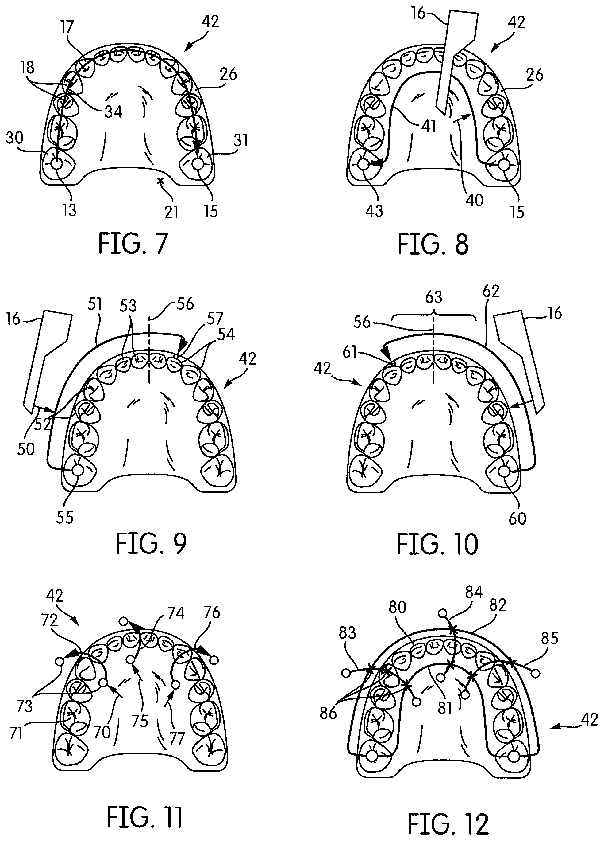 Patent US12303110 Figure 7 – Method and system for guiding an intra-oral scan