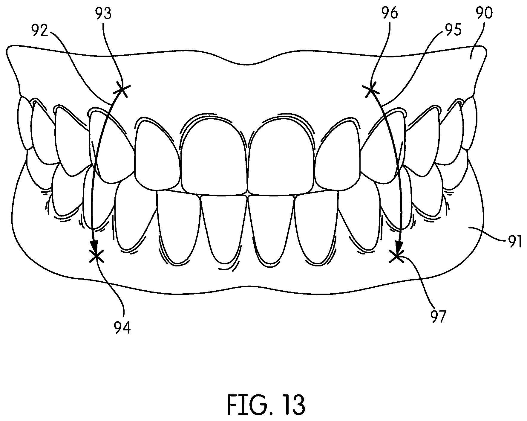 Patent US12303110 Figure 8 – Method and system for guiding an intra-oral scan