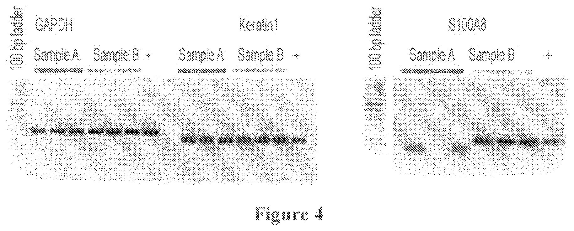 Patent US12303113 Figure 4 – 