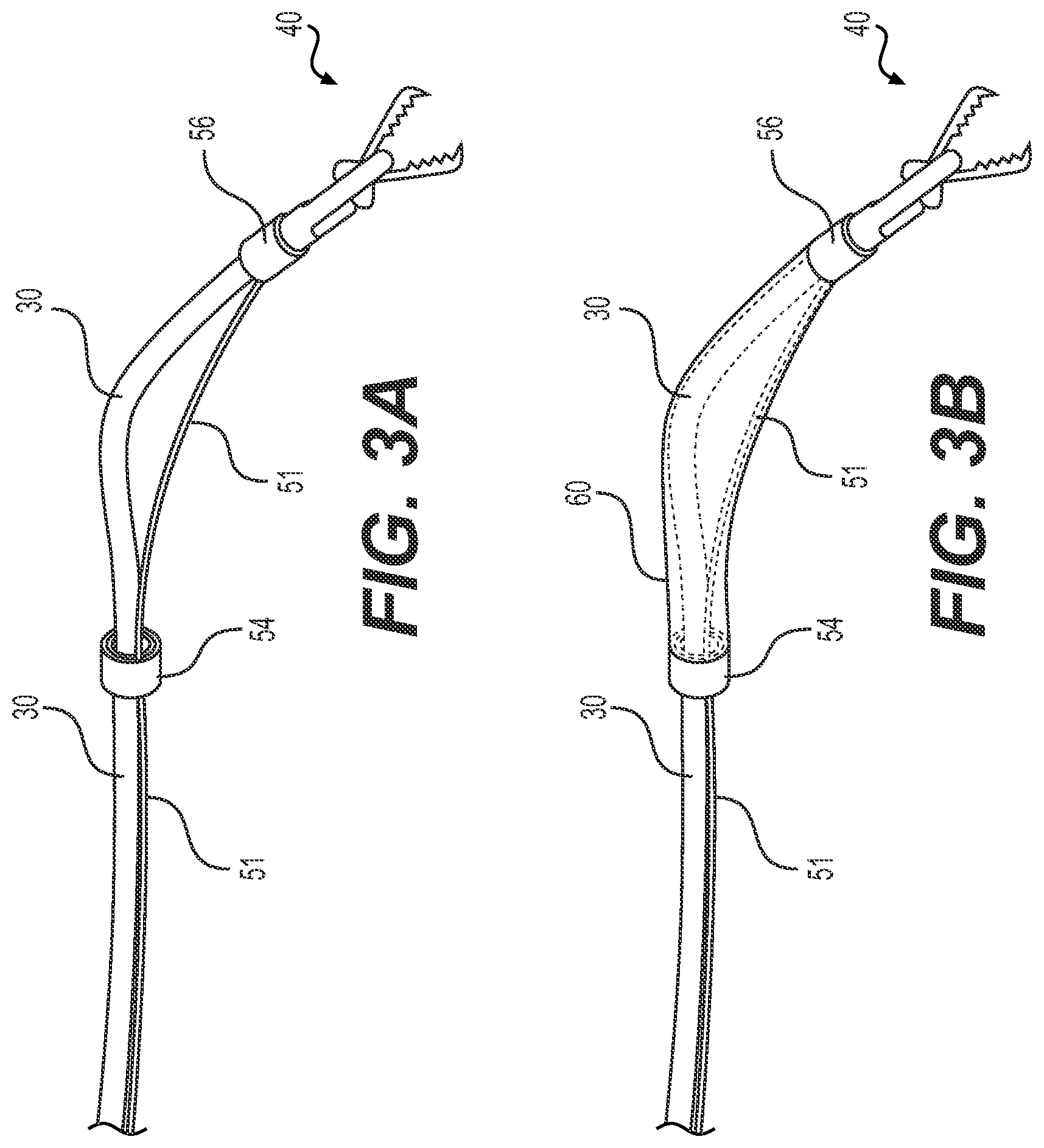 Patent US12303114 Figure 3 – Articulation mechanisms and methods of use
